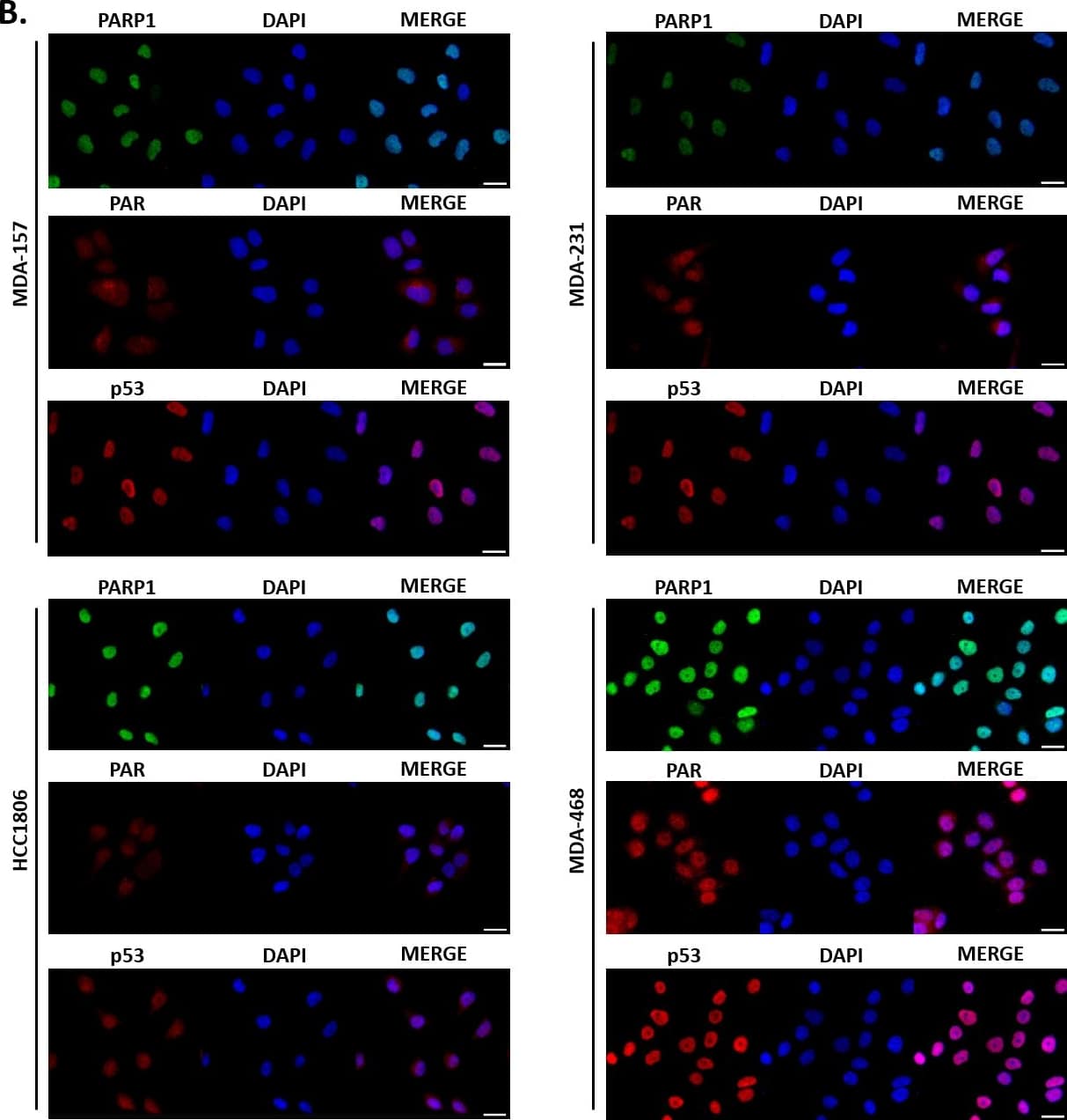 Immunocytochemistry/ Immunofluorescence 53BP1 Antibody - BSA Free