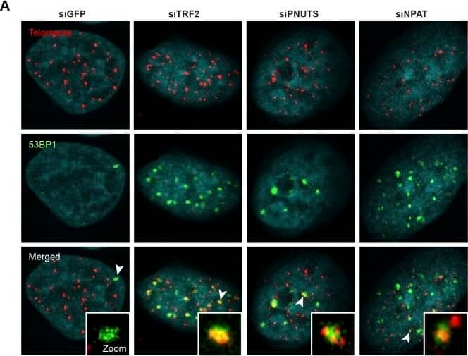 Immunocytochemistry/ Immunofluorescence: 53BP1 Antibody - BSA Free [NB100-304] - Depletion of PNUTS & NPAT induces a global DDR.(A) Induction of telomere dysfunction–induced foci (TIF) upon candidate knockdown in HeLa cells from Fig 5. Depletion of TRF2 was used as a positive control. 53BP1 was detected by indirect IF & telomeres by FISH with a Cy3-[CCCTAA]3 probe. (B) Frequency distribution of the number of TIFs per cell from (A). n indicates the number of cells analyzed for each condition & red lines mark the mean. Image collected & cropped by CiteAb from the following publication (//pubmed.ncbi.nlm.nih.gov/30456372), licensed under a CC-BY license. Not internally tested by Novus Biologicals.