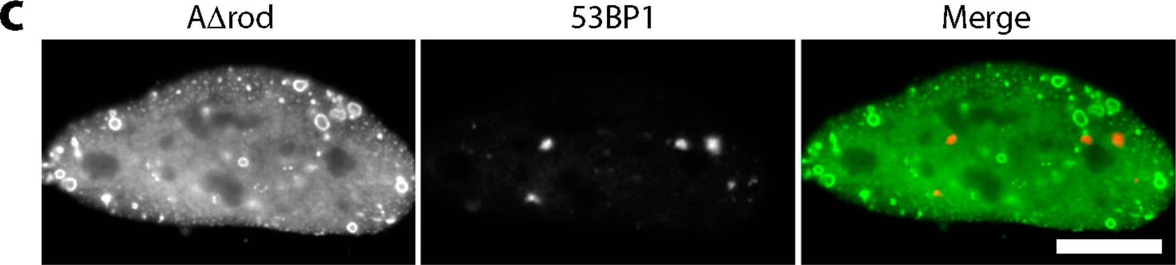 Immunocytochemistry/ Immunofluorescence: 53BP1 Antibody - BSA Free [NB100-304] - General chromatin effects of A∆rod & A∆rod∆hbs. (a) DNA staining (DAPI) in U2OS cells expressing A∆rod. Chromatin staining tended to be stronger on or around lamin A∆rod structures. (b) pRb is a known binding partner of lamin A, & so, it was co-stained as a positive control, revealing strong co-localization with the A∆ structures. (c) No co-localization between A∆rod structures & 53BP1 in HeLa cells indicates that chromatin is not damaged by the structures. (d) Similarly,  gamma H2AX did not accumulate on A∆ structures. Image collected & cropped by CiteAb from the following publication (//www.mdpi.com/2073-4409/6/2/9), licensed under a CC-BY license. Not internally tested by Novus Biologicals.