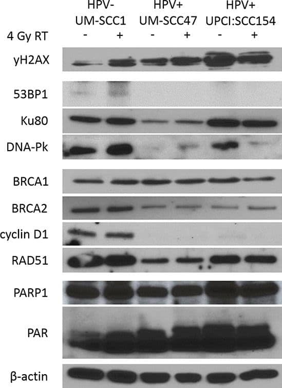 Western Blot: 53BP1 Antibody - BSA Free [NB100-304] - HPV+ HNSCCs have decreased expression of NHEJ & HR proteins including DNA-Pk & BRCA2Cells were treated with mock or 4 Gy radiation, harvested & lysed at 15 minutes post-treatment, & analyzed by western blot for relative expression of indicated proteins.  beta -actin was used as a loading control. Shown is a representative blot from 2 independent experiments. Image collected & cropped by CiteAb from the following publication (//pubmed.ncbi.nlm.nih.gov/26336991), licensed under a CC-BY license. Not internally tested by Novus Biologicals.