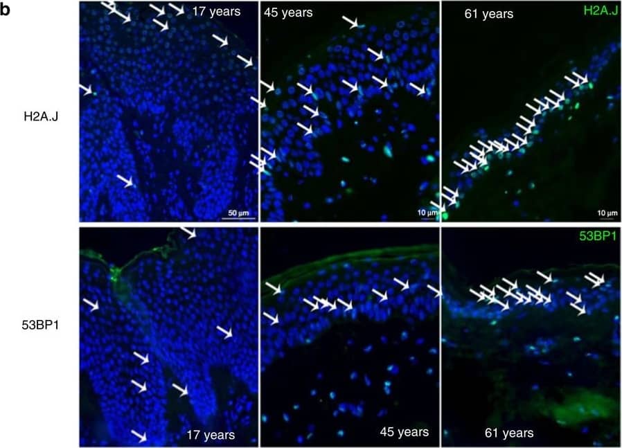 Immunocytochemistry/ Immunofluorescence: 53BP1 Antibody - BSA Free [NB100-304] - H2A.J accumulates in the aging human epidermis.(a) H2A.J & Ki-67 co-localization in sections of human skin of the indicated ages by immunofluorescent staining. H2A.J showed mutually exclusive staining with the Ki-67 proliferation marker. (b) H2A.J & 53BP1 foci increase in aging human epidermis. Arrows indicate positively-stained nuclei. A quantification of positive cells for three biological replicates is shown below the immunofluorescence images, & the one-sided Mann–Whitney U-test was used to determine the statistical significance (*P<0.05, **P<0.01). Error bars represent mean±s.e. Image collected & cropped by CiteAb from the following publication (//www.nature.com/articles/ncomms14995), licensed under a CC-BY license. Not internally tested by Novus Biologicals.