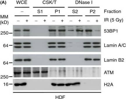 Western Blot: 53BP1 Antibody - BSA Free [NB100-304] - 53BP1 cofractionates with lamins A/C in HDF. (A) HDF were treated with IR (5 Gy, 1 h) & fractionated by sequential treatments of detergent (CSK/T) & DNase I. Extracts were then processed for immunoblotting using the indicated antibodies. WCE, whole cell extract. P, pellet; S, supernatant. (B) HDF were treated with IR (2 Gy; 1 h) & extracted in situ with CSK/T followed by DNase I digestion before being processed for immunofluorescence using lamin A/C & 53BP1 antibodies. Scale bar, 10 μm. Image collected & cropped by CiteAb from the following publication (//pubmed.ncbi.nlm.nih.gov/25645366), licensed under a CC-BY license. Not internally tested by Novus Biologicals.