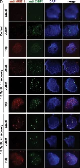 Immunocytochemistry/ Immunofluorescence: 53BP1 Antibody - BSA Free [NB100-304] - MRE11 poly(T)11/12 sequence variant has no apparent functional consequence on DNA damage detection & repair.(A) Electropherograms & sequencing traces of the MRE11 poly(T)11 tract in leukemia/lymphoma cells: Daudi (heterozygous insertion of one bp, poly(T)11/12); Jurkat (heterozygous deletion of one bp, poly(T)10/11); & Raji (wild-type, poly(T)11). (B) MRE11 expression in Daudi, Jurkat & Raji cells. qRT-PCR was used to calculate the ratio of MRE11 expression (amplification of exons 2 to 4) relative to the GAPDH control, independently of the presence of the aberrant transcript observed in Jurkat. PCR products were loaded on the gel at saturation of the reaction, being not quantitative. MRE11 protein levels were assessed by Western blot, & were considerably lower in Jurkat. (C) ATM-pS1981 levels were assessed by Western blot in Daudi, Jurkat & Raji after 1.5 Gy irradiation of cells & 1 h, 4 h or 24 h recovery. There was an increase of ATM phosphorylation 1 h after irradiation in Daudi & Raji cells that decreased at the later time points. Jurkat showed no ATM phosphorylation after exposure to irradiation. (D) DNA repair foci was observed by immunofluorescence after 1.5 Gy IR followed by 1 h & 4 h recovery. Irradiation resulted in the formation of both MRE11 & 53BP1 foci in Daudi & Raji cells, whereas Jurkat failed to form MRE11 foci. Nuclei were counterstained with DAPI. Merged figure presents co-localization of MRE11 & 53BP1 foci visualized in yellow. Image collected & cropped by CiteAb from the following publication (//pubmed.ncbi.nlm.nih.gov/21637783), licensed under a CC-BY license. Not internally tested by Novus Biologicals.
