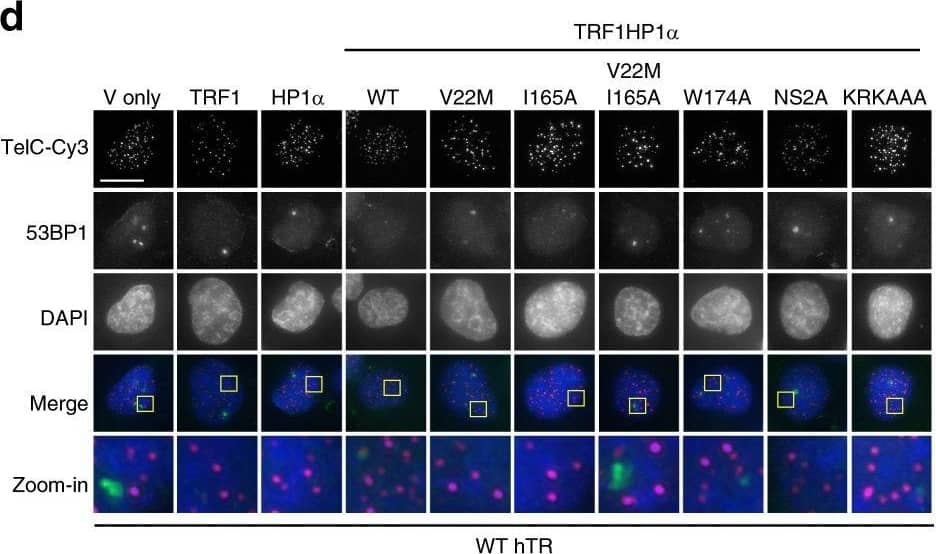 Immunocytochemistry/ Immunofluorescence: 53BP1 Antibody - BSA Free [NB100-304] - TRF1HP1 alpha  results in reduced TIFs induced by mutant hTR expression. Cells stably expressing TRF1HP1 alpha  (WT or mutant variants of HP1 alpha ) were infected with lentivirus containing WT hTR, or mutant hTR (47A or TSQ1) on day 0, selected for stable expression after 48 h, & analyzed on day 5. a Fluorescence microscopy images of representative cells expressing mutant hTR 47A stained with telomeric (Tel-Cy3) peptide nucleic acid (PNA) probes (magenta in merged image) via fluorescent in situ hybridization (FISH), antibody against DNA-damage repair protein marker 53BP1 (green in merged image), & counterstained with DAPI. Zoom-in images (the last row) correspond to yellow-squared regions of the row above. b % TIF per telomere of each nucleus is quantified; n = 94–159 nuclei combining data of three independent experiments. ****p < 0.0001; n.s. (no significance). a, b Scale bar: 10 µm. c Upon TSQ1 expression, TRF1HP1 alpha  results in fewer TIFs compared to Vonly, TRF1 or HP1 alpha  controls. TRFHP1 alpha  ~11.4% shows decreased TIFs compared to Vonly: ~19.7% ***p = 0.0008; TRF1: ~20.4% ***p = 0.0005; HP1 alpha : ~17.9% *p = 0.0137 (n = 30–38 nuclei). b, c Significance is assessed by one-way ANOVA & Dunnett’s multiple comparison test with 95% confidence level. d Fluorescence images of control cells overexpressing WT hTR (n = 27–36 nuclei). Same color scheme as a. TIFs quantification in the presence of e WT hTR or f Vonly (n = 28–36 nuclei) show minimal baseline DNA damage at telomeres. b, c; e, f Error bars represent s.e.m. Image collected & cropped by CiteAb from the following publication (//pubmed.ncbi.nlm.nih.gov/30181605), licensed under a CC-BY license. Not internally tested by Novus Biologicals.