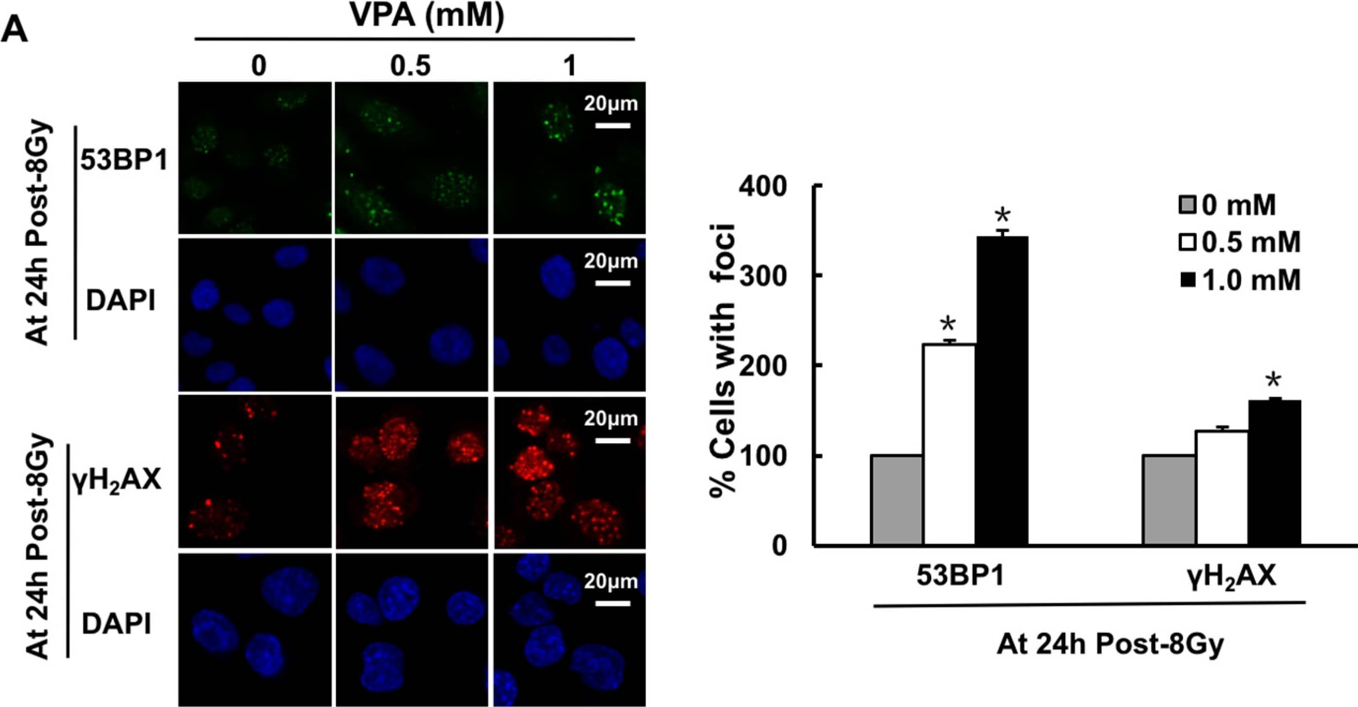 Immunocytochemistry/ Immunofluorescence: 53BP1 Antibody - BSA Free [NB100-304] - VPA at a safe dose can lead to the dysfunction of DNA repair function. (A) The images represent  gamma H2AX & 53BP1 foci formation in U2OS cells treated with 0.5 or 1.0 mM VPA at 24 h post-IR treatment (left panel), & the percentage of cells with  gamma H2AX foci or 53BP1 foci formation in each group was calculated (right panel, the cell with >10 foci was called positive & counted). DAPI was used for nuclear staining; (B) The relative DNA damage in primary-culture tumor cells at 120 min post-IR was analyzed by comet assay (upper), &  gamma H2AX foci formation in primary-culture tumor cells at 24 h post-IR was presented，“+” & “−“ indicated whether VPA was added in the groups (lower left) & calculated (lower right); (C) The clonogenic survival assay was used to detect survival in the U2OS cells treated with the combination of 0.5 or 1.0 mM VPA with 10 μM ABT888 (PARPi). Each data point in the graphs was from three independent experiments (mean ± SD). p-Values were calculated by Student’s t-test (* p < 0.05). Image collected & cropped by CiteAb from the following publication (//pubmed.ncbi.nlm.nih.gov/28489060), licensed under a CC-BY license. Not internally tested by Novus Biologicals.