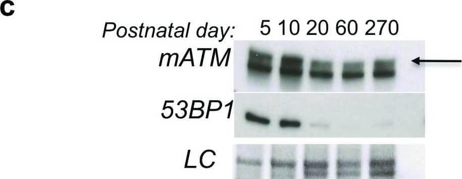 Western Blot: 53BP1 Antibody - BSA Free [NB100-304] - Loss of ATM function in retina.(a) Retinal explants pretreated with ATM inhibitor (ATMi) or PI3K inhibitor (DDRi) are irradiated & sections analyzed for  gamma H2AX. (b) ATM knockout adult mice retina analyzed for irradiation dependent  gamma H2AXaccumulation. (c) Western blot analysis of ATM & 53BP1 in micro-dissected neuronal retina. LC, Coomassie-equivalent staining of gels used as loading control (representation of n=2 independent repeats). (d) Cartoon depiction of domains of ATM protein. (e) Neural retina of mice was microdissected & cDNA was prepared. PCR performed using indicated domain-specific primers onATM mRNA. Unlike FATC & TAN domain coding mRNA; the FAT-domain containing mRNA could be observed even in 5-month-old adult mice retina, indicating the presence of an alternatively spliced form of ATM in the retina. Image collected & cropped by CiteAb from the following publication (//pubmed.ncbi.nlm.nih.gov/30345028), licensed under a CC-BY license. Not internally tested by Novus Biologicals.