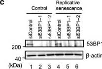 Western Blot: 53BP1 Antibody - BSA Free [NB100-304] - BETd blocks 53BP1 function in senescent cells.a Early passage (control) or late passage (replicative senescence) TIG-3 cells were treated with 10 nM ARV825 (+) or vehicle (−) for 4 days. These cells were then subjected to western blotting using the antibodies shown on the right after immunoprecipitation with the antibodies shown at the top of the panel (IP:). b–f Early passage (control) or late passage (replicative senescence) TIG-3 cells were transfected with previously validated two different siRNA oligos against 53BP1 or control siRNA oligo twice at 2 days intervals. These cells were then subjected to RT-qPCR analysis (b), western blotting analysis (c), the cell proliferation analysis (d), immunofluorescence staining using the antibodies shown on the left (e) or neutral comet assay (f). Representative photographs of the cells in the indicated culture conditions are shown & the histogram shown at the bottom of the panel indicates the relative cell number (d). The number of  gamma H2AX foci, above threshold intensity per nucleus (n = 50) was quantified & shown at the bottom of the e. The average tail olive moments were shown at the bottom of the f. Each box indicates the median & 25% & 75% quantiles, & the whiskers represent the minimum & maximum observations (e, f). For all graphs, error bars indicate mean ± s.d. (n = 3 for b, n = 4 for d) & the representative data from three independent experiments were shown. Statistical significance was determined with two-tailed unpaired Student’s t-test (b), one-way ANOVA followed by Tukey multiple comparison test (d), one-way ANOVA followed by Holm-Sidak multiple comparison test (e, f). P values < 0.05 were considered significant. Source data are provided as a Source Data file. Image collected & cropped by CiteAb from the following publication (//pubmed.ncbi.nlm.nih.gov/32321921), licensed under a CC-BY license. Not internally tested by Novus Biologicals.