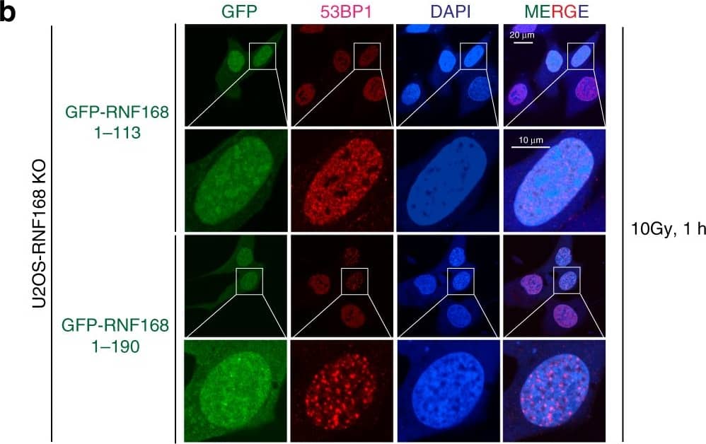 Immunocytochemistry/ Immunofluorescence: 53BP1 Antibody - BSA Free [NB100-304] - UDM1 is required for RNF168-mediated 53BP1 recruitment.a Schematic illustration of RNF8 & RNF168 structural domain organization, RNF168 fragments, & chimeric proteins used as in b & c. FHA–forkhead-association domain; coiled-coil–coiled-coil domain; RING–ubiquitin E3 ligase RING domain; Rs-arginine anchor; LRM–LR motif; UMI–UIM-and MIU-related ubiquitin binding domain; MIU–motif interacting with ubiquitin. b–c Transient transfection of GFP-tagged RNF168 fragments & chimeric proteins in U2OS RNF168 KO cells. Cells were irradiated with 10 Gy & allowed to recover for 1 h followed by immunofluorescence analysis using 53BP1 antibody as indicated. Cells were counterstained with DAPI. Repeated at least two times independently with similar results. Source data are provided as Source Data file. Image collected & cropped by CiteAb from the following publication (//pubmed.ncbi.nlm.nih.gov/32424115), licensed under a CC-BY license. Not internally tested by Novus Biologicals.