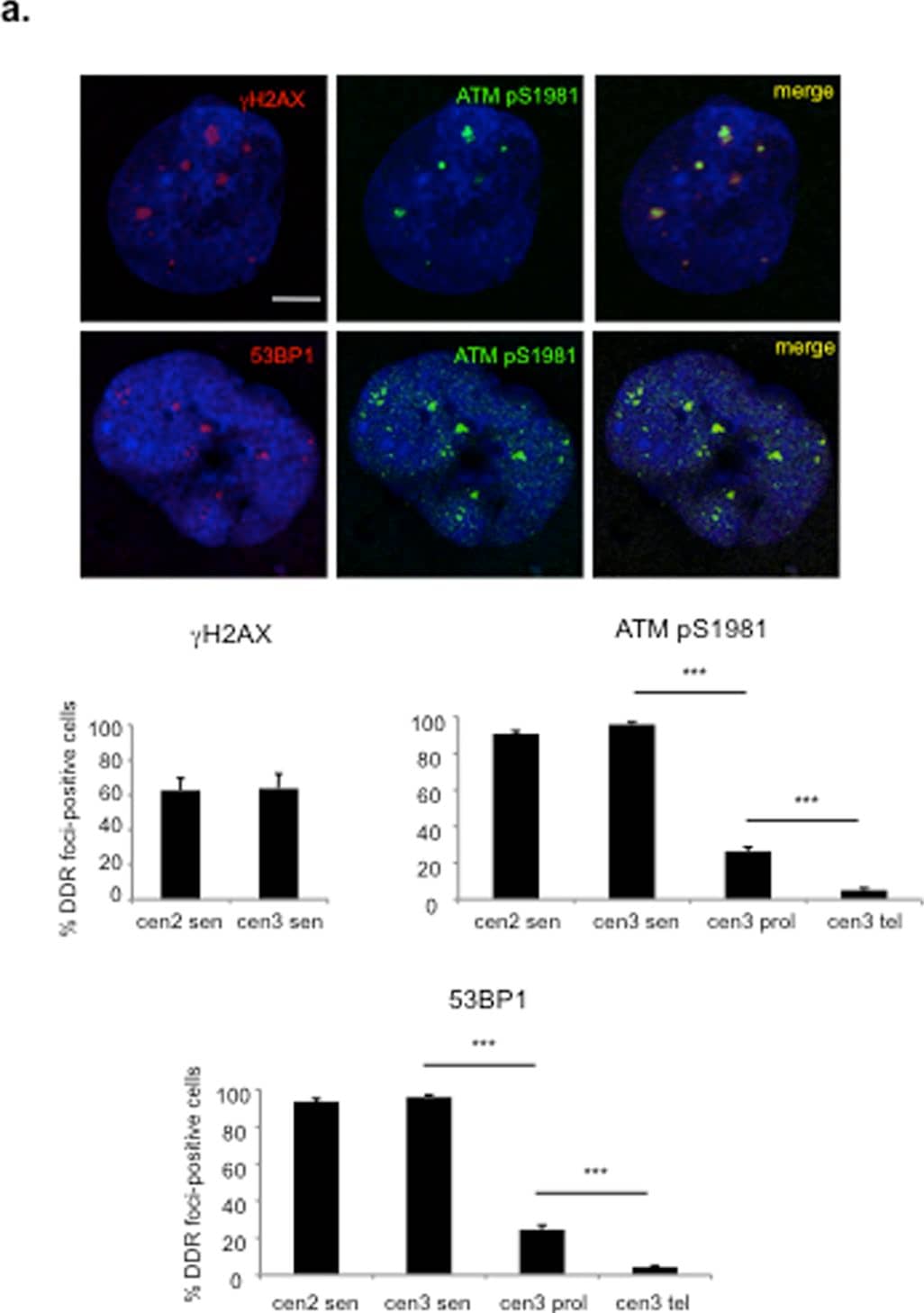 Immunocytochemistry/ Immunofluorescence: 53BP1 Antibody - BSA Free [NB100-304] - Telomere-initiated senescent cells retain active DDR foci for years after senescence establishment.a. DDR, in the form of ATM pS1981 foci co-localizing with 53BP1 &  gamma H2AX foci, is detectable three years after senescence establishment. Scale bar, 10 µm. Below, bar graphs show the percentage of cells positive ± s.e.m. for the indicated DDR markers, in senescent (sen), early passage proliferating (prol) or telomerized proliferating (tel) skin fibroblasts from two independent centenarian donors (cen2 & cen3). Cells were considered positive if bearing more than 3 DDR foci (*** p-value <0.001). b. SA-beta -gal staining of the two batches, cen2 & cen3, is shown together with the percentage of BrdU-positive cells. Scale bar, 100 µm. Image collected & cropped by CiteAb from the following publication (//dx.plos.org/10.1371/journal.pone.0110969), licensed under a CC-BY license. Not internally tested by Novus Biologicals.