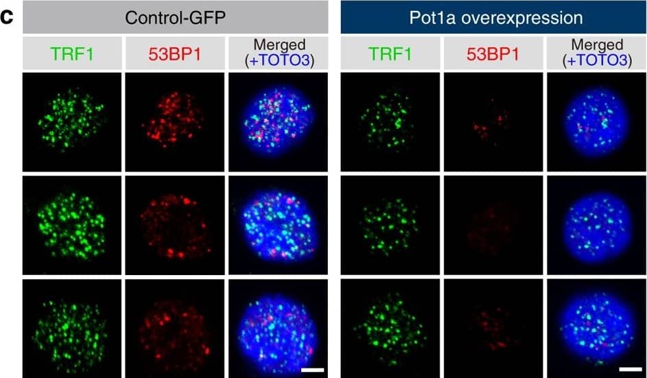 Immunocytochemistry/ Immunofluorescence: 53BP1 Antibody - BSA Free [NB100-304] - Pot1a prevents DDR in HSCs. a, b Telomeric DDR in 8 week-old LSK cells upon Pot1a knockdown. a Immunocytochemical staining of TRF1 (green) & 53BP1 (red). Foci co-stained with TRF1 & 53BP1 were identified as TIFs. Nuclei were stained with TOTO3 (blue). Scale bar, 2 μm. b Frequency of TIFs per cell after 1 week of culture. Data are expressed as the mean ± SD (n = 100, *p < 0.01 by t-test). Representative data from three independent experiments are shown. c–f Telomeric DDR in donor-derived control-GFP or Pot1a overexpressing 8 week-old LSK cells 4 months post BMT. c Immunocytochemical staining of TRF1 (green) & 53BP1 (red). Nuclei were stained with TOTO3 (blue). Scale bar, 2 μm. d Frequency of TIFs per cell. Data are expressed as the mean ± SD (n = 120, *p < 0.01 by t-test). Representative data from 3 independent experiments are shown. e Immunocytochemical staining of TRF1 (green) & RPA32 (red). f Immunocytochemical staining of TRF1 (green) & pChk1 (red). Scale bar, 2 μm. g Flow cytometric analysis of Chk1 & pChk1 in donor-derived GFP+ LSKCD48–CD150+ cells after 5 months of 2nd BMT. Mean fluorescence intensity of Chk1 & pChk1 (left panels). Data are expressed as the mean ± SD (n = 3, *p < 0.01 by t-test). Representative FACS profiles of Chk1 & pChk1 in donor-derived GFP+ LSKCD48–CD150+ cells (right panels) Image collected & cropped by CiteAb from the following publication (//pubmed.ncbi.nlm.nih.gov/28986560), licensed under a CC-BY license. Not internally tested by Novus Biologicals.