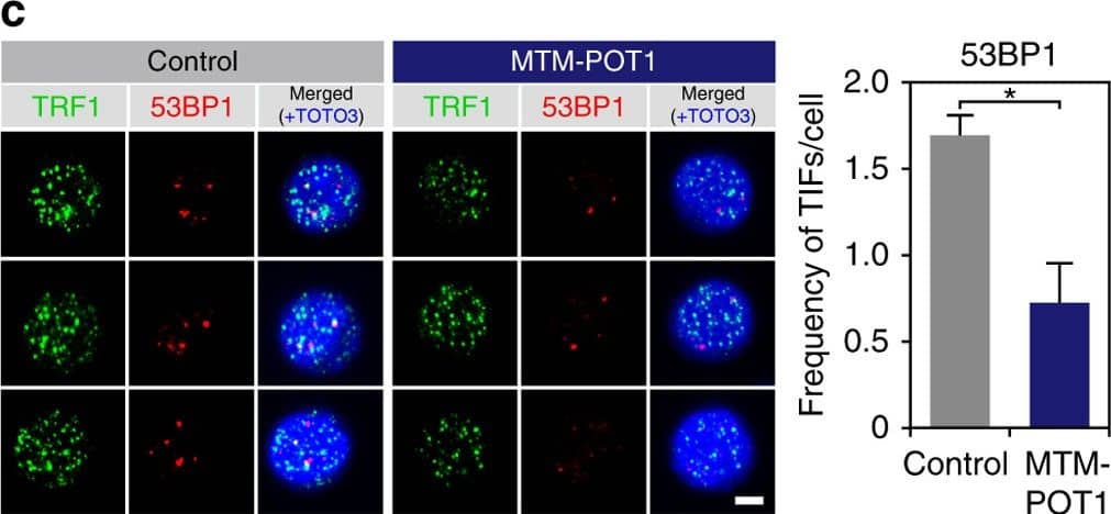 Immunocytochemistry/ Immunofluorescence: 53BP1 Antibody - BSA Free [NB100-304] - POT1 prevents DDR in human HSC. a Expression of POT1 in hCB CD34+ cells & LT-HSCs (Lin–CD34+CD38−CD45RA−CD90+CD49f+). b hCB-derived LT-HSCs were cultured with MTM-POT1. After 10 days of culture, cells were isolated & re-cultured in methylcellulose medium (200 cells per dish). The number of CFU-C & HPP-CFC (>1.0 mm, >2.0 mm) are shown. Data are expressed as the mean ± SD (n = 3, *p < 0.01 by t-test). Representative data from three independent experiments are shown. c, d hCB LT-HSCs were cultured for 10 days with control MTM protein or MTM-POT1. After 10 days of culture, LT-HSCs were re-isolated & number of TIF was examined. c Immunocytochemical staining of TRF1 (green), 53BP1 (red), & TOTO3 (blue). Scale bar, 2 μm (left). Frequencies of TIFs after 10 days of culture (right). Data are expressed as the mean ± SD (n = 100: control, n = 100: MTM-POT1, *p < 0.01 by t-test). Representative data from 2 independent experiments are shown. d Immunocytochemical staining of TRF1 (green), RPA32 (red), & TOTO3 (blue). Scale bar, 2 μm (left). Frequencies of TIFs after 10 days of culture (right). Data are expressed as the mean ± SD (n = 110–120: control, n = 110: MTM-POT1, *p < 0.01 by t-test). Representative data from two independent experiments are shown Image collected & cropped by CiteAb from the following publication (//pubmed.ncbi.nlm.nih.gov/28986560), licensed under a CC-BY license. Not internally tested by Novus Biologicals.