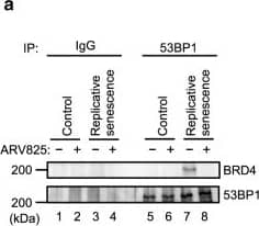 Western Blot: 53BP1 Antibody - BSA Free [NB100-304] - BETd blocks 53BP1 function in senescent cells.a Early passage (control) or late passage (replicative senescence) TIG-3 cells were treated with 10 nM ARV825 (+) or vehicle (−) for 4 days. These cells were then subjected to western blotting using the antibodies shown on the right after immunoprecipitation with the antibodies shown at the top of the panel (IP:). b–f Early passage (control) or late passage (replicative senescence) TIG-3 cells were transfected with previously validated two different siRNA oligos against 53BP1 or control siRNA oligo twice at 2 days intervals. These cells were then subjected to RT-qPCR analysis (b), western blotting analysis (c), the cell proliferation analysis (d), immunofluorescence staining using the antibodies shown on the left (e) or neutral comet assay (f). Representative photographs of the cells in the indicated culture conditions are shown & the histogram shown at the bottom of the panel indicates the relative cell number (d). The number of  gamma H2AX foci, above threshold intensity per nucleus (n = 50) was quantified & shown at the bottom of the e. The average tail olive moments were shown at the bottom of the f. Each box indicates the median & 25% & 75% quantiles, & the whiskers represent the minimum & maximum observations (e, f). For all graphs, error bars indicate mean ± s.d. (n = 3 for b, n = 4 for d) & the representative data from three independent experiments were shown. Statistical significance was determined with two-tailed unpaired Student’s t-test (b), one-way ANOVA followed by Tukey multiple comparison test (d), one-way ANOVA followed by Holm-Sidak multiple comparison test (e, f). P values < 0.05 were considered significant. Source data are provided as a Source Data file. Image collected & cropped by CiteAb from the following publication (//pubmed.ncbi.nlm.nih.gov/32321921), licensed under a CC-BY license. Not internally tested by Novus Biologicals.