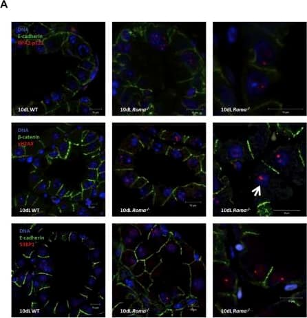 Immunocytochemistry/ Immunofluorescence: 53BP1 Antibody - BSA Free [NB100-304] - Absence of Roma Leads to Activation of the DNA Damage Response & Genomic Instability(A) Representative immunofluorescence analysis of RPA2-pT21,  gamma H2AX, & 53BP1 foci in tissue sections from WT & Roma−/− glands at 10dL. The white arrow indicates nucleolar  gamma H2AX. Scale bars, 10 μm. The higher magnification panels on the right have been chosen to highlight the foci & are not zoomed images of the left panels.(B) Immunoblot analysis of cell-cycle checkpoint & DNA damage response in extracts from WT & Roma−/− glands at 10dL. Extracts from U2OS cells treated with 5mM HU were used as a damage control.(C) PCR analysis of p21Cip1 & MDM2 & quantitative real-time PCR analysis of p21Cip1 in extracts from 10dL WT & Roma−/− glands (p = 0.0007, Student’s t test).(D) Representative spectral karyotypes (top) & metaphase spreads (bottom panel) prepared from MECs isolated from WT & Roma−/− glands after a full natural wean.See also Figure S2. Image collected & cropped by CiteAb from the following publication (//pubmed.ncbi.nlm.nih.gov/27149840), licensed under a CC-BY license. Not internally tested by Novus Biologicals.