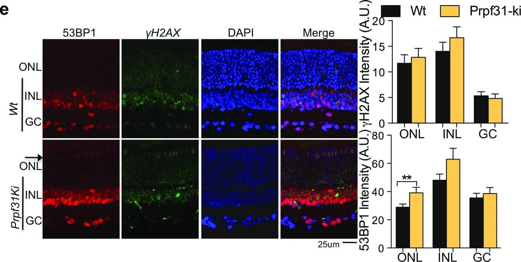 Immunocytochemistry/ Immunofluorescence: 53BP1 Antibody - BSA Free [NB100-304] - Loss of functional PRPF31 induce RNA:DNA hybrid dependent genomic instability but not in mice retinal neurons.(a andb)  gamma H2AX & 53BP1 foci analysis in PRPF31 siRNA-transfected RPE-1 cells. (c & d)  gamma H2AX & 53BP1 foci analysis in vasculo-stromal fraction derived primary cells fromPrpf31+/A216P mice (Prpf31-ki). (e)  gamma H2AX & 53BP1 foci analysis in retina fromPrpf31+/A216P mice on postnatal day 20. All column bars represent the mean. For (a-d) “n”, mentioned on respective column, signify number of cells analyzed from two independent experiments. For (e) n=16 for each column & signify number of retinal sections analyzed; acquired from n=4 eyes. Error bars represent Standard error of Mean (SEM). *P≤0.05; **P<0.01, ***P<0.001 using Mann-Whitney test (a,b), Kruskal-Wallis test followed by Dunn’s post hoc test (c,d); & two tailed unpaired Student’s t-test (e). Image collected & cropped by CiteAb from the following publication (//pubmed.ncbi.nlm.nih.gov/30345028), licensed under a CC-BY license. Not internally tested by Novus Biologicals.