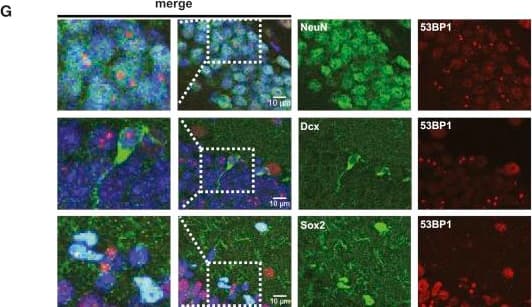 Immunocytochemistry/ Immunofluorescence: 53BP1 Antibody - BSA Free [NB100-304] - Increased Neurogenesis in the Absence of INK4a/ARF Expression Is Independent of Apoptosis & Microglial Activation(A) Quantification of the number of apoptotic cells, as detected by TUNEL, in the DG 6 hr following exposure of WT, ink4a/arf-deficient (INK4a/ARF KO), & p53-deficient (p53 KO) mice to 6 Gy cranial IR. Indicated is the average number of apoptotic cells per DG section (n = 4 mice per group).(B) Quantification of CD68 expression in the DG 24 hr following exposure of mice to IR.(C) Representative confocal images showing CD68+ cells (in red) next to apoptotic TUNEL+ cells (in green) following exposure of WT mice to IR. Note the increase in CD68 signal & side by side localization of CD68+ & TUNEL+ cells following IR.(D–F) Proportion of neurons (NeuN, in green), young neurons (DCX, in green), & progenitor cells (Sox2, in green) showing persistent DNA damage foci (53BP1, in red) in the hippocampus of mice sacrificed 8 weeks post exposure to IR. Nuclei were stained with DAPI.(G) Representative confocal images of brain sections from irradiated WT mice displaying 53BP1 DNA damage foci with the indicated cell markers are shown. Images were acquired by a Leica microsystems TSC SP8 HyVolution confocal microscope & an HC PL APO CS2 40×/1.3 oil objective. The p values (∗p < 0.05; ∗∗∗p < 0.001) were obtained by performing a Student's t test. ND (no cells were detected). Image collected & cropped by CiteAb from the following publication (//linkinghub.elsevier.com/retrieve/pii/S2213671118301528), licensed under a CC-BY license. Not internally tested by Novus Biologicals.