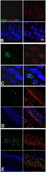 Immunocytochemistry/ Immunofluorescence: 53BP1 Antibody - BSA Free [NB100-304] - TRF2/Terc double null mutant mice exhibit DNA damage response at short telomeres in epidermisA. Average telomere length ratios in CD34+ stem, Lgr6+ stem, & basal cells from K14Cre;TRF2+/+;Terc+/+, K14Cre;TRF2f/f;Terc+/+, K14Cre;TRF2+/+;Terc-/-, & K14Cre;TRF2f/f;Terc-/- epidermis were determined by qPCR. Error bars represent SEM. Co-localization of 53BP1 (shown by immunofluorescence, AlexaFluor 488) at telomeres (shown by fluorescence in situ hybridization, Cy3) in histopathologic sections from K14Cre;TRF2+/+;Terc+/+ B., K14Cre;TRF2f/f;Terc-/- C., K14Cre;TRF2+/+;Terc-/- D., & K14Cre;TRF2f/f;Terc+/+ E. epidermis is shown. Nuclei are counterstained with DAPI. Scale bar = 5 μm. Phospho-ATM expression in histopathologic sections from K14Cre;TRF2+/+;Terc+/+ F., K14Cre;TRF2f/f;Terc-/- G., K14Cre;TRF2+/+;Terc-/- H., & K14Cre;TRF2f/f;Terc+/+ I. epidermis. Phospho-Chk2 expression in histopathologic sections from K14Cre;TRF2+/+;Terc+/+ J., K14Cre;TRF2f/f;Terc-/- K., K14Cre;TRF2+/+;Terc-/- L., & K14Cre;TRF2f/f;Terc+/+ M. epidermis. p53 protein expression in histopathologic sections from K14Cre;TRF2+/+;Terc+/+ N., K14Cre;TRF2f/f;Terc-/- O., K14Cre;TRF2+/+;Terc-/- P., & K14Cre;TRF2f/f;Terc+/+ Q. epidermis. Representative sections are shown. Image collected & cropped by CiteAb from the following publication (//pubmed.ncbi.nlm.nih.gov/29113290), licensed under a CC-BY license. Not internally tested by Novus Biologicals.