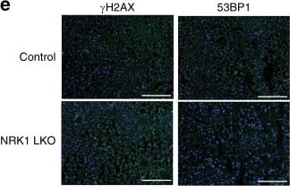 Immunocytochemistry/ Immunofluorescence: 53BP1 Antibody - BSA Free [NB100-304] - NRK1 deletion curbs PARP activity & exacerbates DNA damage. a NAD+ levels in the liver of NRK1 LKO mice upon LFD & HFD (n = 8 for all groups except NRK1 LKO on HFD, n = 10; 24 weeks of age). b NR (left), NMN (center) & NAM (right) levels in the liver of NRK1 LKO & control mice upon HFD (n = 6 mice per group). c mRNA level of genes involved in the NAD+ biosynthesis pathways (n = 8 mice for the control group, n = 10 mice for the NRK1 LKO group). d Levels of poly(ADP-ribose) protein modification, PARP1, SIRT1, NAMPT, & GAPDH in the liver of NRK1 LKO & control mice on HFD. e Representative staining (top) & quantification (bottom) of  gamma H2AX (left) & 53BP1 (right) immunofluorescence on liver sections from NRK1 LKO & control mice on HFD (n = 4 mice per group, ×10 magnification, DAPI counterstaining, scale bars: 200 μm). Results shown are mean ± SEM, * & *** indicate statistical difference vs. control group at p < 0.05 & p < 0.001, respectively. The individual values & statistical tests used for each panel can be found in the Source Data file Image collected & cropped by CiteAb from the following publication (//pubmed.ncbi.nlm.nih.gov/31541116), licensed under a CC-BY license. Not internally tested by Novus Biologicals.