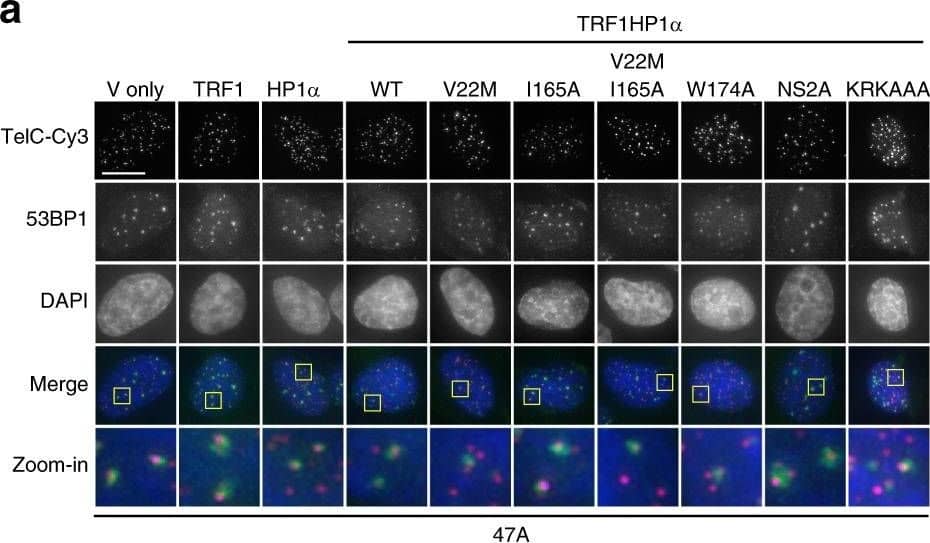 Immunocytochemistry/ Immunofluorescence: 53BP1 Antibody - BSA Free [NB100-304] - TRF1HP1 alpha  results in reduced TIFs induced by mutant hTR expression. Cells stably expressing TRF1HP1 alpha  (WT or mutant variants of HP1 alpha ) were infected with lentivirus containing WT hTR, or mutant hTR (47A or TSQ1) on day 0, selected for stable expression after 48 h, & analyzed on day 5. a Fluorescence microscopy images of representative cells expressing mutant hTR 47A stained with telomeric (Tel-Cy3) peptide nucleic acid (PNA) probes (magenta in merged image) via fluorescent in situ hybridization (FISH), antibody against DNA-damage repair protein marker 53BP1 (green in merged image), & counterstained with DAPI. Zoom-in images (the last row) correspond to yellow-squared regions of the row above. b % TIF per telomere of each nucleus is quantified; n = 94–159 nuclei combining data of three independent experiments. ****p < 0.0001; n.s. (no significance). a, b Scale bar: 10 µm. c Upon TSQ1 expression, TRF1HP1 alpha  results in fewer TIFs compared to Vonly, TRF1 or HP1 alpha  controls. TRFHP1 alpha  ~11.4% shows decreased TIFs compared to Vonly: ~19.7% ***p = 0.0008; TRF1: ~20.4% ***p = 0.0005; HP1 alpha : ~17.9% *p = 0.0137 (n = 30–38 nuclei). b, c Significance is assessed by one-way ANOVA & Dunnett’s multiple comparison test with 95% confidence level. d Fluorescence images of control cells overexpressing WT hTR (n = 27–36 nuclei). Same color scheme as a. TIFs quantification in the presence of e WT hTR or f Vonly (n = 28–36 nuclei) show minimal baseline DNA damage at telomeres. b, c; e, f Error bars represent s.e.m. Image collected & cropped by CiteAb from the following publication (//pubmed.ncbi.nlm.nih.gov/30181605), licensed under a CC-BY license. Not internally tested by Novus Biologicals.
