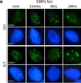 Immunocytochemistry/ Immunofluorescence: 53BP1 Antibody - BSA Free [NB100-304] - A-T post-mitotic neurons are defective in DDR. In a, D30 post-mitotic neurons (D30) were tested by western blot with antibodies specific for the various ATM phosphosubstrates & cleaved PARP at various times after treatment with 5 Gy IR.  beta -Actin was used as a loading control. DNA SSBs (b) & DSBs (c) were analyzed in neurons (D30) by alkaline & neutral comet assay, respectively, at two different times after treatment. 20 min after H2O2 or IR treatment was considered the time point with the maximum DNA damage. In b & c, representative photos of comets from untreated cells & at different time points following treatment. The ratio between treated & untreated tail moments of at least 50–70 cells per experimental point is shown in the graphs (values in %). One representative experiment out of three is shown. In d & e, formation & resolution of IR-induced nuclear foci. Neurons (D30) were irradiated with 0.5 Gy, collected at the indicated times & labeled for  gamma -H2AX (d) & 53BP1 (e). For each treatment, the number of foci was scored from 100 cell nuclei per duplicate preparations & from three independent experiments (mean±S.D.) (d & e, bottom) For each time point, the difference between Ctrl & A-T was statistically significant (#P<0.01) (analysis performed by the Student's t-test) Image collected & cropped by CiteAb from the following publication (//pubmed.ncbi.nlm.nih.gov/25032865), licensed under a CC-BY license. Not internally tested by Novus Biologicals.