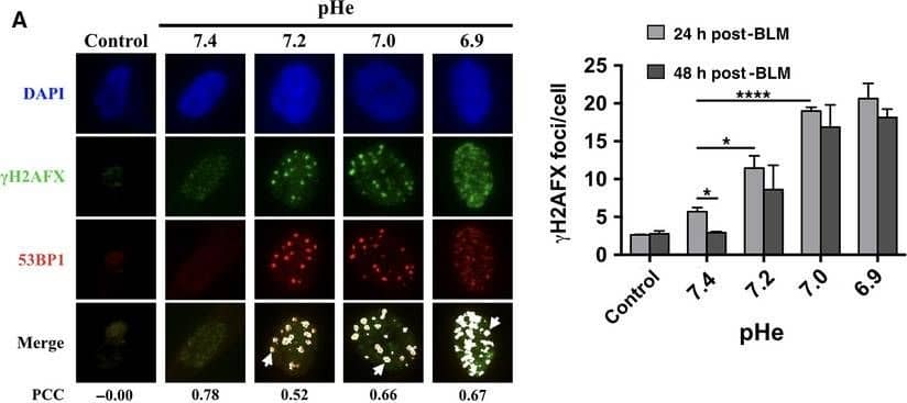 Immunocytochemistry/ Immunofluorescence: 53BP1 Antibody - BSA Free [NB100-304] - Persistence of repair foci at suboptimal pHe. (A) Left panel shows immunofluorescence detection of  gamma H2AFX & 53BP1 following 24 h recovery from bleomycin treatment. Control, sample before damage induction. Colocalization is shown in white; PCC, Pearson correlation coefficient score. Right panel corresponding to  gamma H2AFX foci/cell at 24 h & 48 h following recovery. Only foci larger than 10 pixels were counted. Experiments were performed in triplicate. Values are mean ± SEM. *P < 0.05, ****P < 0.00005. (B) Immunoblots for the detection of  gamma H2AFX & histone H4. Right panel shows  gamma H2AFX/H4 ratios at indicated pHe values. C, control before damage induction. Quantitation of three independent immunoblots is shown on the right. Values are mean ± SEM. *P < 0.05. (C) Immunofluorescence detection of  gamma H2AFX after 48‐h incubation in range of pHe values tested without BLM treatment. Right panel corresponding to  gamma H2AFX foci/cell at 48 h of pHe incubation. Only foci larger than 10 pixels were counted. Experiments were performed in triplicate. Values are mean ± SEM. *P < 0.05. Image collected & cropped by CiteAb from the following publication (//pubmed.ncbi.nlm.nih.gov/29511618), licensed under a CC-BY license. Not internally tested by Novus Biologicals.