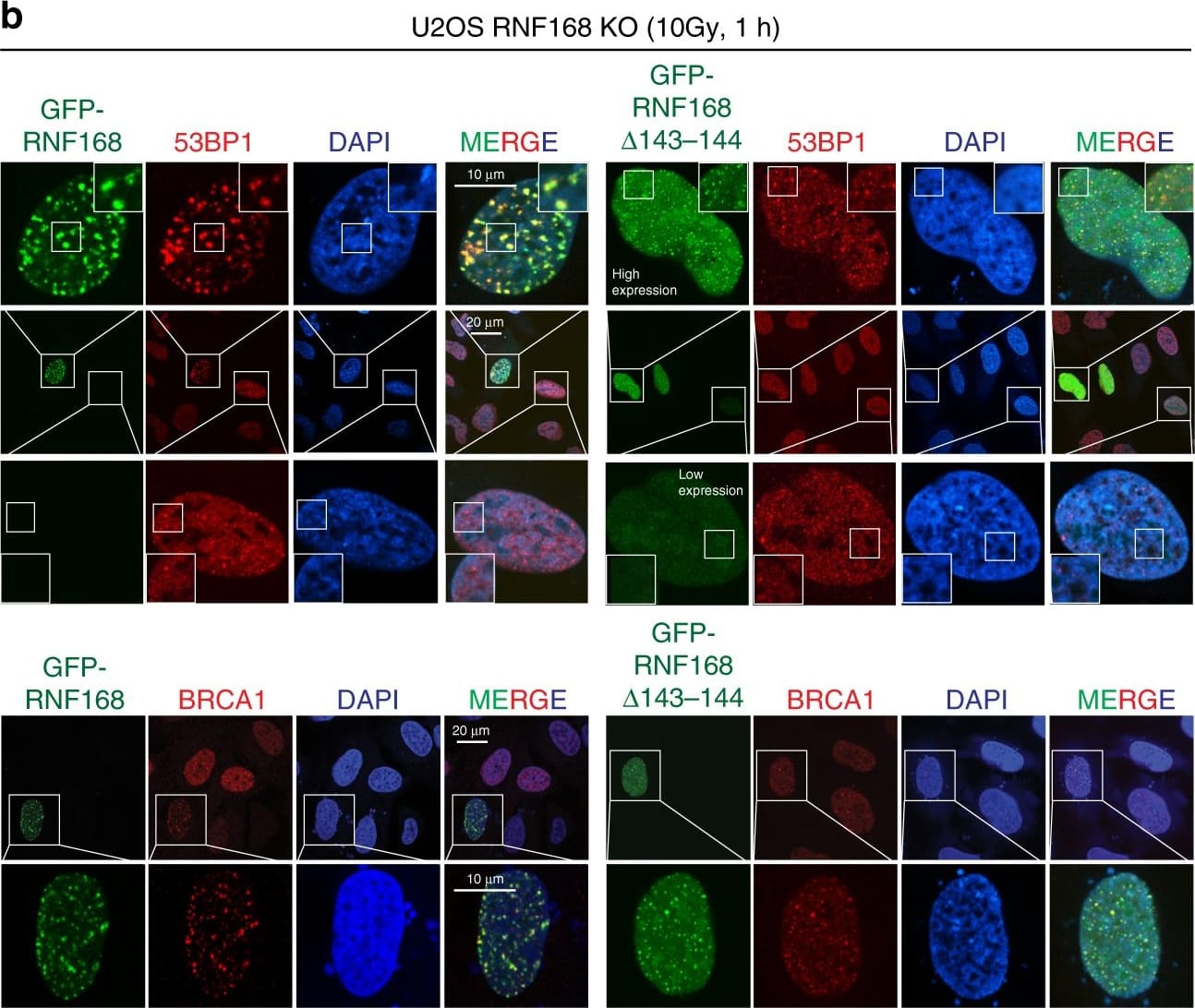 Immunocytochemistry/ Immunofluorescence: 53BP1 Antibody - BSA Free [NB100-304] - UMI acidic residues are required for RNF168-mediated site-specific ubiquitination & the DDR.a Sequence alignment analysis of RNF168 UMI domains across species. The evolutionary conserved E143/E144 are highlighted in red. b Deletion of residues 143-144 attenuates 53BP1 IRIF formation. U2OS RNF168 KO cells were transiently transfected with GFP-RNF168 or RNF168  delta 143-144. Cells were irradiated with 10 Gy, allowed to recover for 1 h, followed by immunofluorescence analysis with indicated antibodies. Repeated three times with similar results. c Deletion of 143-144 abolishes RNF168-mediated ubiquitination. Co-transfection of GFP-RNF168 or mutant with Flag-H2AX K13/K15 only vector in HEK293T cells followed by western blot analysis. Repeated three times with similar results. d RNF168  delta 143-144 is recruited to laser damage. U2OS RNF168 KO cells expressing GFP-RNF168 & RNF168  delta 143-144 were damaged using a 405 nm laser source & analyzed 15 min later by confocal microscopy. Dotted line indicates the laser path. Repeated three times independently with similar results. e–f U2OS cells were transfected with GFP-RNF168 wildtype & mutants. Proximity ligation assay (PLA) was performed using specific antibodies against GFP &  gamma H2AX. Mean intensity of PLA signals in GFP-positive cells were measured & analyzed using ImageJ software. Data presented as mean ± SD. One-way ANOVA, Dunn’s multiple comparison test was used in statistical analysis, wildtype vs. R57D P = 0.1455, wildtype vs.  delta 143-144 P = 0.1589, R57D vs.  delta 143-144, P > 0.9999, ****P < 0.0001 with 95% confidence interval. n = 75 (wildtype), 48 (R57D), 74 ( delta 143-144), 53 (R57D/ delta 143-144) over 3 independent experiments. Source data are provided as Source Data file. Image collected & cropped by CiteAb from the following publication (//pubmed.ncbi.nlm.nih.gov/32424115), licensed under a CC-BY license. Not internally tested by Novus Biologicals.