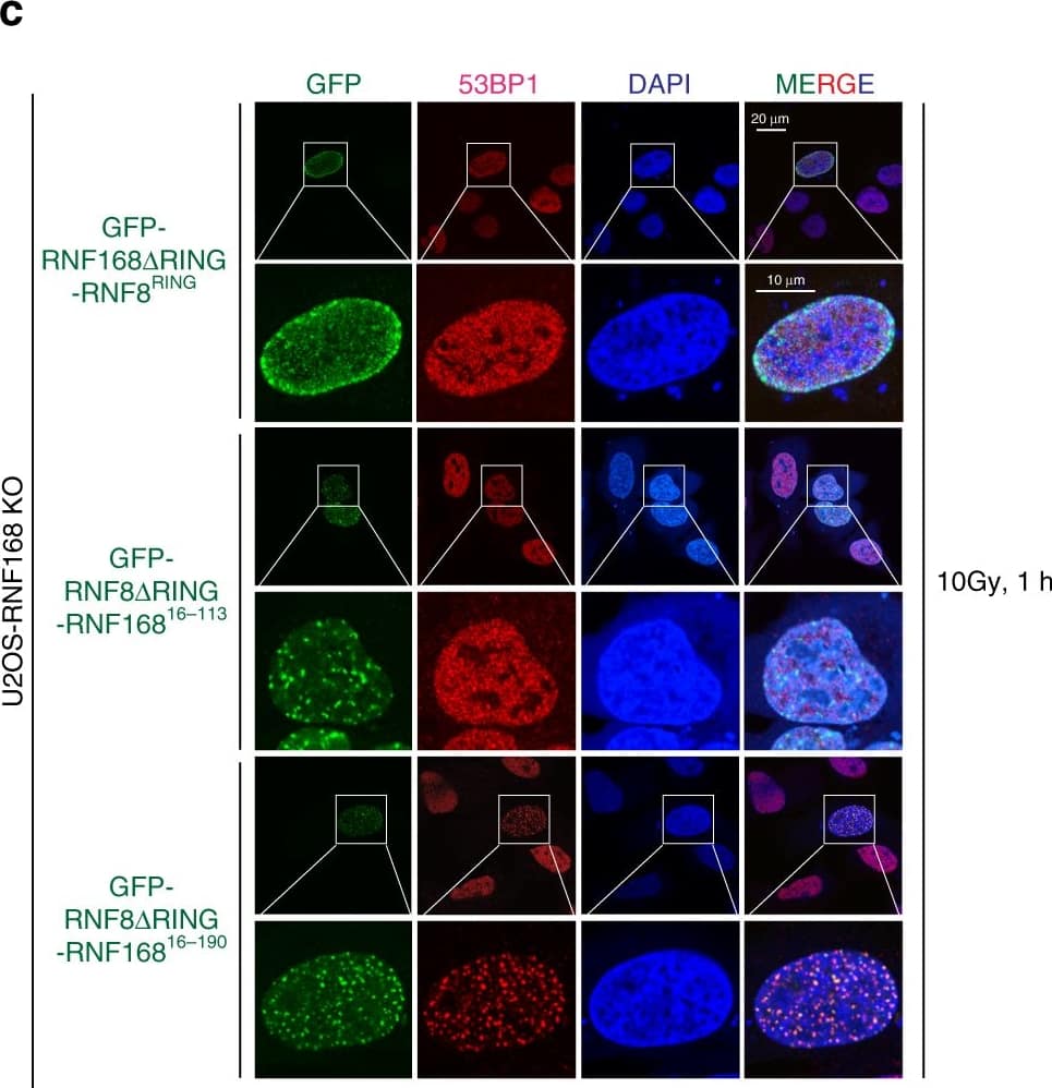Immunocytochemistry/ Immunofluorescence: 53BP1 Antibody - BSA Free [NB100-304] - UDM1 is required for RNF168-mediated 53BP1 recruitment.a Schematic illustration of RNF8 & RNF168 structural domain organization, RNF168 fragments, & chimeric proteins used as in b & c. FHA–forkhead-association domain; coiled-coil–coiled-coil domain; RING–ubiquitin E3 ligase RING domain; Rs-arginine anchor; LRM–LR motif; UMI–UIM-and MIU-related ubiquitin binding domain; MIU–motif interacting with ubiquitin. b–c Transient transfection of GFP-tagged RNF168 fragments & chimeric proteins in U2OS RNF168 KO cells. Cells were irradiated with 10 Gy & allowed to recover for 1 h followed by immunofluorescence analysis using 53BP1 antibody as indicated. Cells were counterstained with DAPI. Repeated at least two times independently with similar results. Source data are provided as Source Data file. Image collected & cropped by CiteAb from the following publication (//pubmed.ncbi.nlm.nih.gov/32424115), licensed under a CC-BY license. Not internally tested by Novus Biologicals.