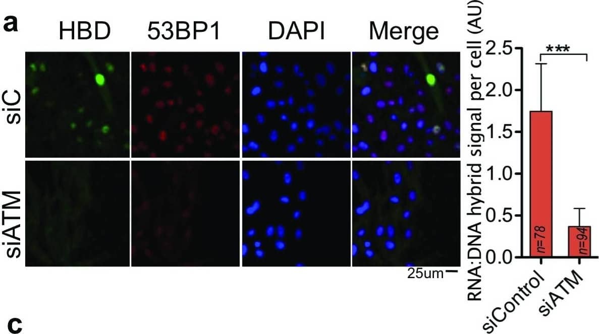 Immunocytochemistry/ Immunofluorescence: 53BP1 Antibody - BSA Free [NB100-304] - RNA:DNA hybrid formation is central to ATM-53BP1 repair pathway.(a) Immunofluorescence using the anti-flag to quantify nuclear hybrid-binding (HB) domain foci signal in pre-permeabilized RPE cells & quantification of HB domain signal in cells treated with siATM, (b) Western blot showing ATM depletion. (c) Immunofluorescence & HB-domain foci quantification in cells treated with ATM inhibitor. (d) Quantitation of  gamma H2AX foci in cells expressing HB domain or active RNAseH1, in presence or absence of H2O2 dependent oxidative stress. siC, non-targeted control siLuciferease RNA. Column bars represent the mean of n number of cells (described on each column) from three independent experiments. Error bars represent SEM. *P ≤ 0.05; **P < 0.01, ***P < 0.001 using Mann-Whitney test (a,c) & Kruskal-Wallis test followed by Dunn’s post hoc test (d). Image collected & cropped by CiteAb from the following publication (//pubmed.ncbi.nlm.nih.gov/30345028), licensed under a CC-BY license. Not internally tested by Novus Biologicals.