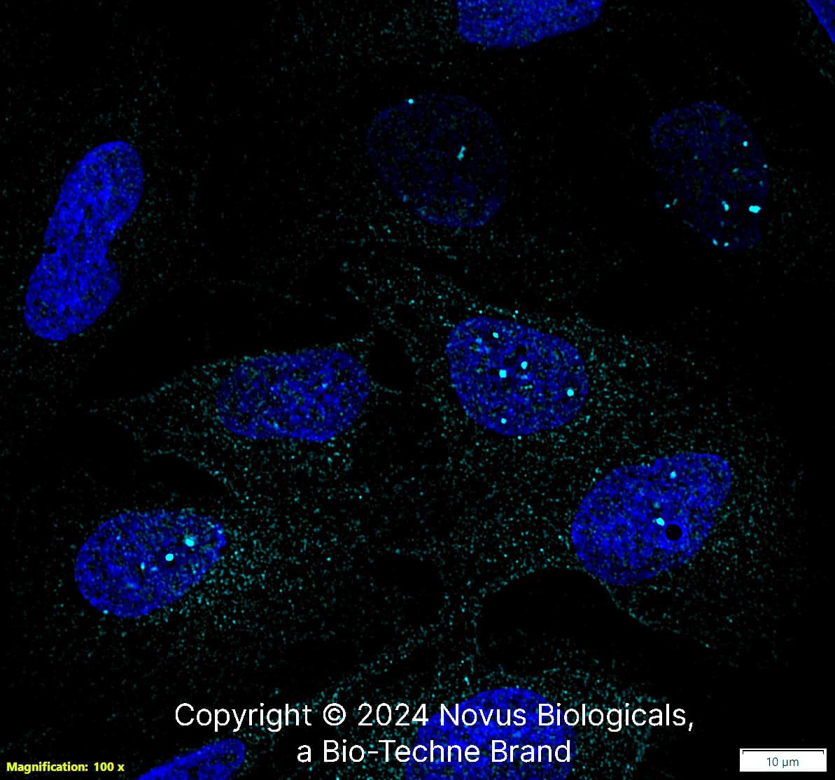 53BP1 was detected in immersion fixed U-2 OS human osteosarcoma cell line using Rabbit anti-53BP1 Antigen Affinity Purified Polyclonal Antibody conjugated to DyLight 650 (Catalog # NB100-304C) (light blue) at 10 µg/mL overnight at 4C. Cells were counterstained with DAPI (blue). Cells were imaged using a 100X objective and digitally deconvolved. 