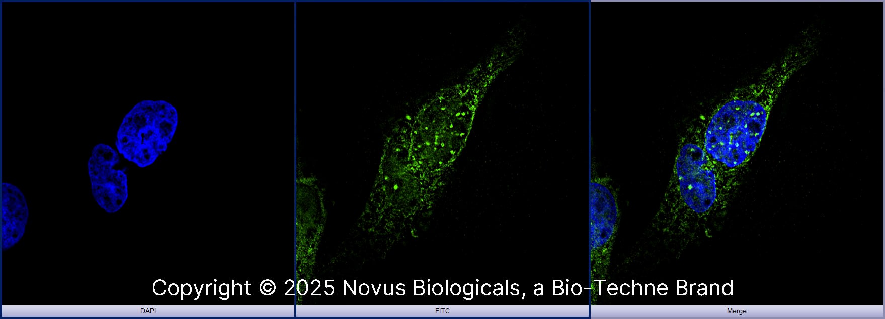 53BP1 was detected in immersion fixed SJCRH30 human Rhabdomyosarcoma cell line using Rabbit anti-53BP1 Antigen Affinity Purified Polyclonal Antibody conjugated to DyLight 488 (Catalog # NB100-304G) (green) at 5 µg/mL overnight at 4C. Cells were counterstained with DAPI (blue). Cells were imaged using a 100X objective and digitally deconvolved. 