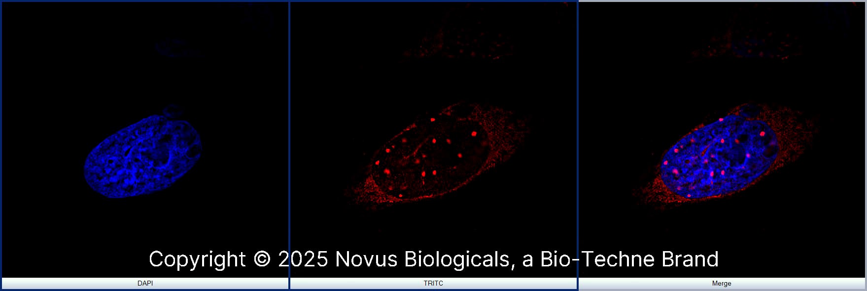 53BP1 was detected in immersion fixed SJCRH30 human Rhabdomyosarcoma cell line using Rabbit anti-53BP1 Antigen Affinity Purified Polyclonal Antibody conjugated to DyLight 550 (Catalog # NB100-304R) (red) at 5 µg/mL overnight at 4C. Cells were counterstained with DAPI (blue). Cells were imaged using a 100X objective and digitally deconvolved. 