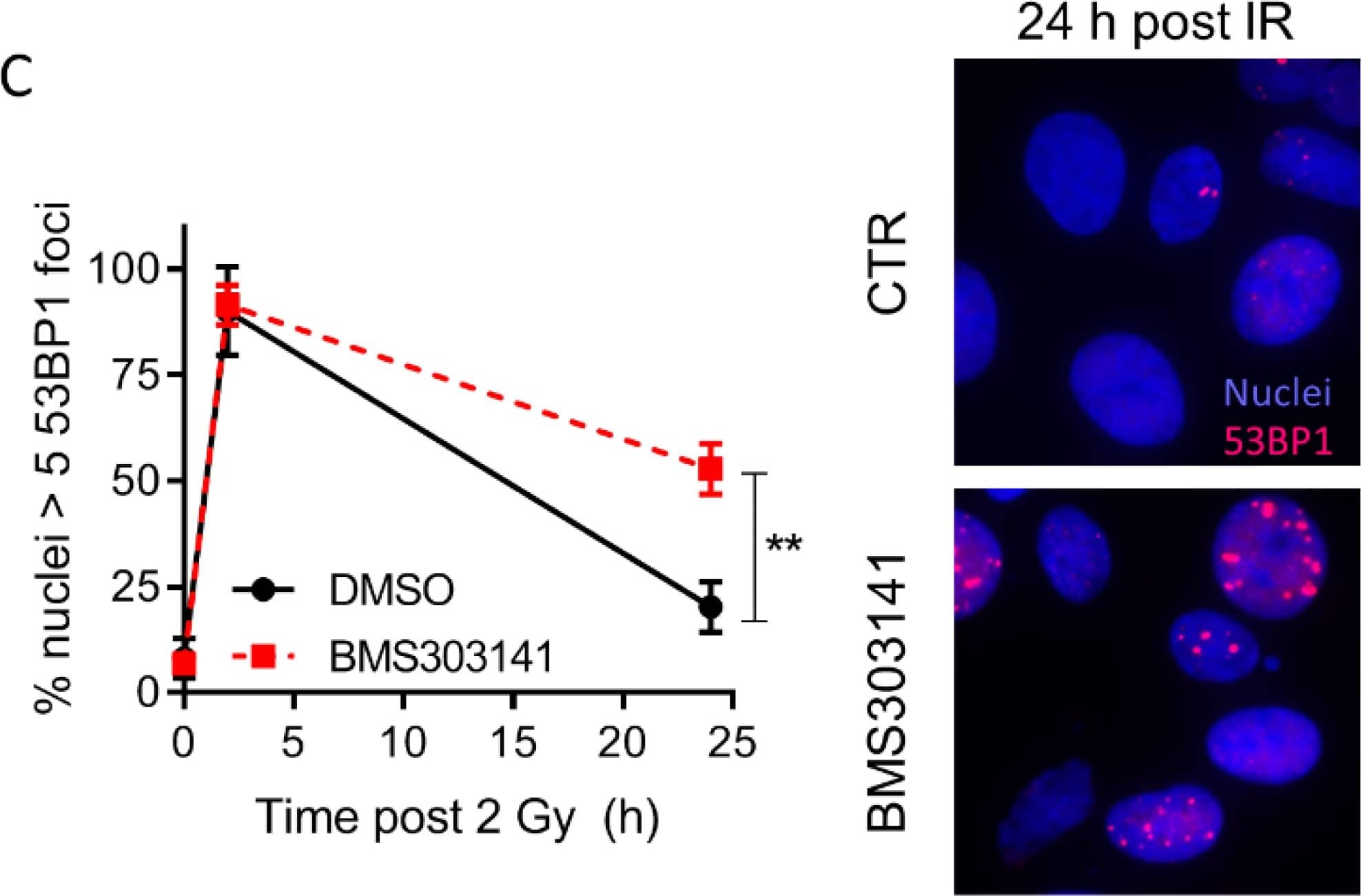 The production of DSBs depends on Top1 degradation in CPT-treated quiescent cells. (A–C) Serum-starved WI38 hTERT cells were co-transfected with siRNAs against cullin 3 and cullin 4B or against a control sequence and then treated with DMSO (−CPT) or 25 μM CPT (+CPT) for 1 h. (A and B) Western blotting of the indicated proteins.  alpha Tubulin: loading control. (C) Number of  gamma H2AX foci per nucleus from one representative experiment (246–348 nuclei were analyzed for each treatment) out of three. ***P 5 53BP1 foci/nucleus in a single plane of view) in UM-SCC-6 (C) and UT-SCC-5 (D) cells. Shown are mean percentages of three biological replicates. Immunofluorescent representative images of examples of UM-SCC-6 or UT-SCC-5 cells, 24 h post irradiation, with or without 5 uM BMS303141 pre-treatment. Nuclei in blue, 53BP1 foci in red. (E) Homologous recombination assay. U2OS cells have been stably transfected with a construct containing a GFP gene containing a I-SceI restriction site (SceGFP) as well as a stop codon at the same site. Upon transfection with an I-SceI encoded plasmid, a double strand break is induced at the I-SceI site. Repair of this break via homologous recombination occurs through utilization of the internal GFP (iGFP) fragment downstream of the SceGFP. Successful homologous recombination results in the restoration of a functional GFP gene. (F) U2OS DRGFP cells were treated for 6 h with 5 uM BMS303141 or 5 uM BO2 (Rad51 inhibitor), and transfected with pCBASceI plasmid. 48 h post transfection, cells were harvested and the GFP positive fraction was determined using flow cytometry. Representative images from flow cytometry experiments are shown on the right, with DMSO Sce- as a negative control, and 5 uM B02 Sce+ as a positive control. In the graph, data are shown from two biological replicates. Image collected and cropped by CiteAb from the following open publication (//pubmed.ncbi.nlm.nih.gov/31817870), licensed under a CC-BY license. Not internally tested by Novus Biologicals.