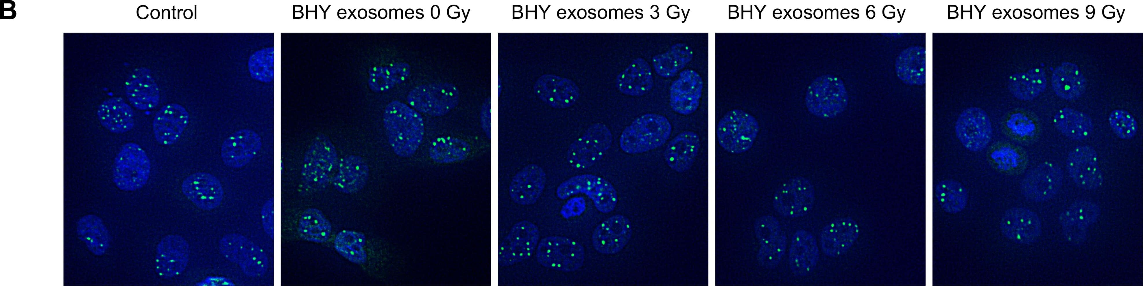 Immunocytochemistry/ Immunofluorescence 53BP1 Antibody - BSA Free