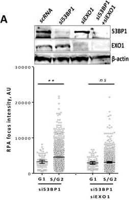 Western Blot: 53BP1 Antibody - BSA Free [NB100-305] - Assessment of satellite cell radiosensitivity & DNA repair pathways w/ age.(A–B) Expression of major proteins involved in homologous recombination & non-homologous end joining detected using WB. Protein nuclear extracts prepared from activated satellite cells 72 hrs post muscle injury. Lamin B used as  loading control. (A) Representative images of WBs. (B) Quantification using Image J software. Data represents mean +/− SEM, n = 3 to 5 (n = a pool of muscles from 3 mice), 2-tailed unpaired Student's t-test, no significant difference. (C) Graphical representation of data from Table S1. Gene expression of old relative to young satellite cells presented as fold change w/ a 95 % confidence interval for the 12 genes w/ a statistically significant relative expression, n = 3 mice per group, two-tailed unpaired Student's t-test, *: p value 0.05. Shown are the mean +/-SEM for three independent experiments. Image collected and cropped by CiteAb from the following open publication (//pubmed.ncbi.nlm.nih.gov/27494840), licensed under a CC-BY license. Not internally tested by Novus Biologicals.