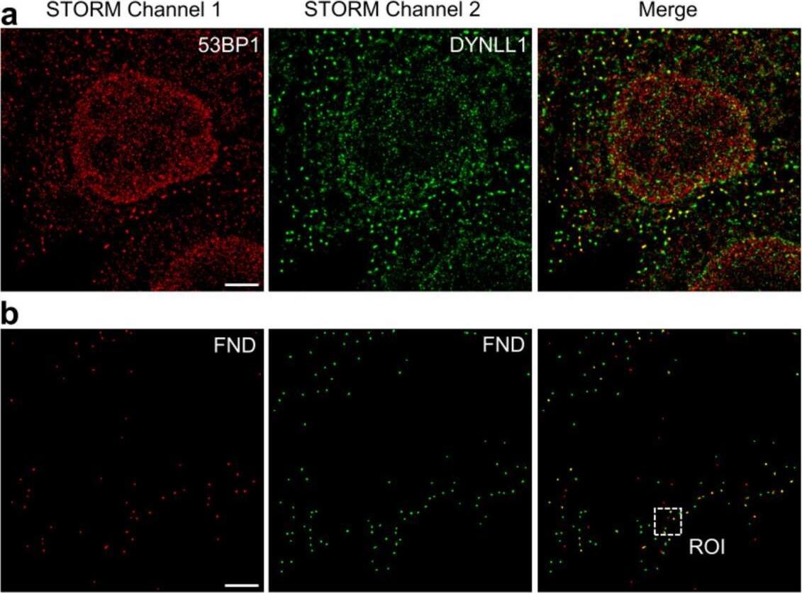 Immunocytochemistry/ Immunofluorescence: 53BP1 Antibody [DyLight 650] [NB100-305C] - Dual-color dSTORM acquisition workflow with fluorescence nanodiamonds (FNDs). (a) Representative dSTORM images of MCF10A cells upon targeting of 53BP1 (red) & DYNLL1 (green), stained with AlexaFluor647 & CF568, respectively. Shown are (from left to right) the single-color 53BP1 & DYNLL1 images & the dual-color dSTORM image. (b) FNDs spots positions obtained from red & green STORM channels. (c) Zoomed region of the highlighted area (white dashed box) in (b). Upper panel the localization events (each colored pixel represents one localized single-molecule event) recorded during the acquisition. Representative FNDs are indicated by the arrows. In the lower panel, the recorded events were transformed into Gaussian PSFs of fixed width & segmented (see Materials & Methods & Supplementary Protocol for details) to highlight the drift correction (Scale bar ROI: 1 μm) (d) Representative images of dual-color dSTORM acquisition. The fluorophore blinking in timelapse imaging (15,000 frames) for each channel (53BP1-AlexaFluor647 & DYNLL1-CF568) is shown. The bright spots in the image correspond to the fluorescence emission of individual fluorophores. Most of the fluorescent labels are switched off such that the fluorescent molecules are well separated. FNDs show no blinking properties, indicating high photostability in both channels. (e,f) Comparison of the photon emission from fluorescent nanodiamonds (FND, 40 nm; black), Alexa Fluor 647 dye (red) & CF568 dye (green) over 2000 acquired frames using 561 nm & 647 nm laser excitations, measured in the highlighted regions (white dashed box). (g) Fluorescence decrease of the 40 nm FNDs (black) & the AlexaFluor647 (red), over 15,000 frames of image. Scale bar: 3 μm. Image collected & cropped by CiteAb from the following publication (//pubmed.ncbi.nlm.nih.gov/35215014), licensed under a CC-BY license. Not internally tested by Novus Biologicals.