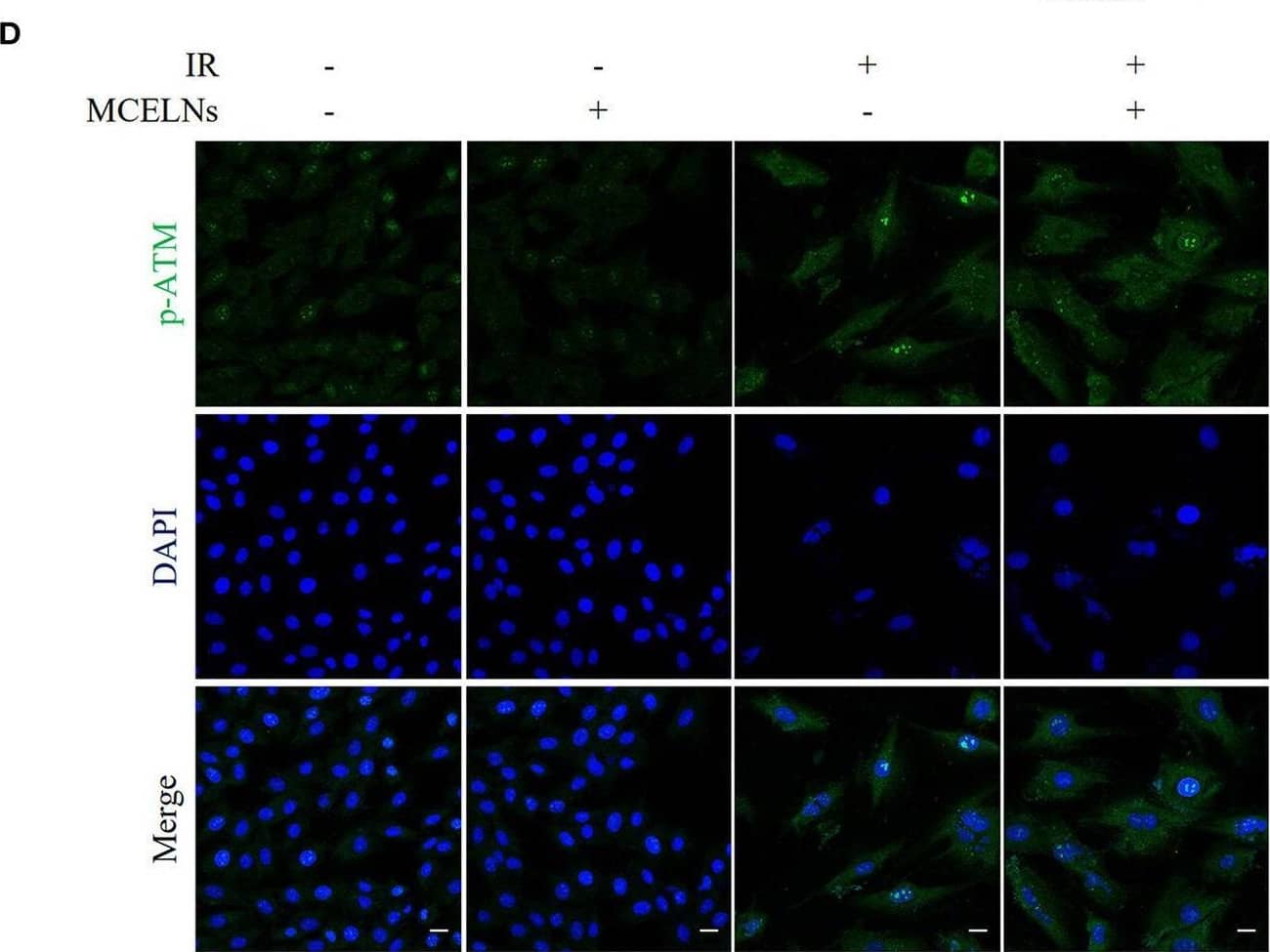 MCELNs decreased the DNA damage of H9C2 cells after radiation. (A) Immunofluorescence staining of  gamma -H2A.X (green) in H9C2 cells after 48 h of culture with indicated treatment. The nucleus were stained with DAPI (blue), scale bar: 10 μm. Western blot images (B) and quantitation (C) of  gamma -H2A.X in H9C2 cells after 48 h of culture with indicated treatment. (D) Immunofluorescence staining of p-ATM (green) in H9C2 cells after 48 h of culture with indicated treatment. The nucleus were stained with DAPI (blue), scale bar: 10 μm. Western blot images (E) and quantitation (F) of p-ATM and ATM in H9C2 cells after 48 h of culture with indicated treatment. IR (–/+): 0/16 Gy X-ray; MCELNs (–/+): 0/10 μg/mL. All data were represented as means +/- SD (n = 3 independent experiments). The statistical significance was evaluated by one-way ANOVA followed by the Turkey's multiple comparisons test among groups. Image collected and cropped by CiteAb from the following open publication (//pubmed.ncbi.nlm.nih.gov/35509278), licensed under a CC-BY license. Not internally tested by Novus Biologicals.