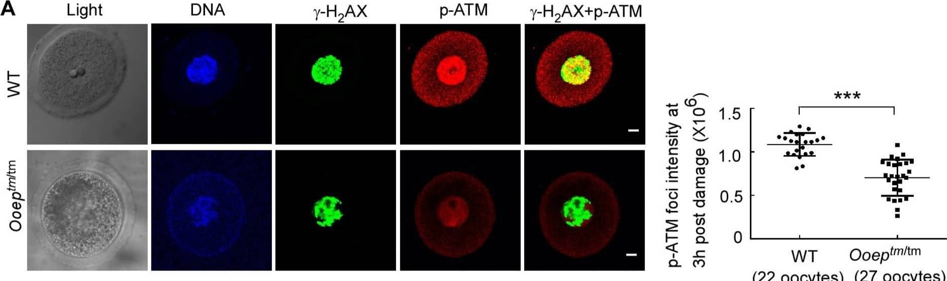 OOEP is required for ATM activation and RAD51 recruitment to DNA damage sites Image collected and cropped by CiteAb from the following open publication (//pubmed.ncbi.nlm.nih.gov/29955025), licensed under a CC-BY license. Not internally tested by Novus Biologicals.