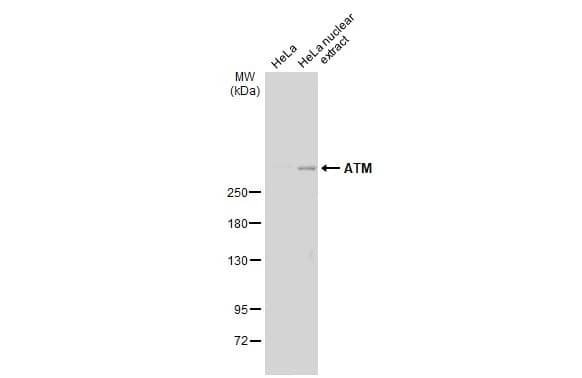 Western Blot: ATM Antibody (2C1) [NB100-309] - HeLa whole cell extract and nuclear extracts (30 ug) were separated by 5% SDS-PAGE, and the membrane was blotted with ATM antibody [2C1] (NB100-309) diluted at 1:500. The HRP-conjugated anti-mouse IgG antibody  was used to detect the primary antibody.