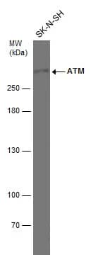 Western Blot: ATM Antibody (2C1) [NB100-309] - Whole cell extract (30 ug) was separated by 5% SDS-PAGE, and the membrane was blotted with ATM antibody [2C1] (NB100-309) diluted at 1:1000.