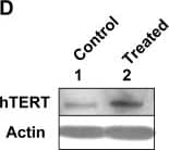 Western Blot: TERT Antibody (2C4) [NB100-317] - Reduced expression levels of IFI16 protein in human normal diploid fibroblasts after treatment with histone deacetylase inhibitor are associated with increased expression of hTERT & increased telomerase activity.(A) Total RNA isolated from untreated (control, lane 1) or CGK1026 (10 µM for 24 h, lane 2) treated young WI-38 fibroblasts was subjected cDNA synthesis followed by semi-quantitative PCR using a pair of primer specific to the IFI16, hTERT, or actin. As a positive control, we used RNA from human HT1080, a human fibrosarcoma cell line. (B) Total RNA isolated from untreated (control) or CGK1026 (10 µM for 24 h; treated) treated young WI-38 fibroblasts was subjected cDNA synthesis, followed by quantitative real-time PCR using the TaqMan assay for the hTERT gene. Results are mean values of triplicate experiments & error bars represent standard deviation (**p<0.005). (C & D) Total protein extracts prepared from untreated (lane 1) or CGK1026 (10 µM for 24 h; treated) treated young WI-38 fibroblasts were subjected to immunoblotting using antibodies specific to the indicated proteins. Image collected & cropped by CiteAb from the following publication (//dx.plos.org/10.1371/journal.pone.0008569), licensed under a CC0-1.0 license. Not internally tested by Novus Biologicals.