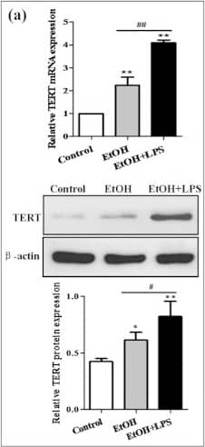 Western Blot: TERT Antibody (2C4) [NB100-317] - Effect of alcohol on TERT expression in vitro.Acute alcohol treatment of RAW 264.7 cells can be achieved with 25 mM EtOH for 24 h. (a) TERT mRNA & protein expression in EtOH-stimulated RAW 264.7 cells were analyzed by real-time PCR & western blot. The results are shown as relative expression against control expression without treatment. The values represent means ± SD. *P < 0.05, **P < 0.01 vs control. #P<0.05, ##P<0.01 vs EtOH-treated group. (b) Effect of alcohol on M1 macrophage markers (TNF-alpha , IL-1 beta , CCL2 & NOS2) in RAW 264.7 cells without or with LPS stimulation. (c) Effect of alcohol on M2 macrophage markers (Arg-1, IL-10, Mrc2 & CD163) in RAW 264.7 cells without or with LPS stimulation. (d) Effect of alcohol on the production of cytokines including TNF-alpha , IL-1 beta , IL-6, IL-12 & IL-10 in RAW 264.7 cells without or with LPS stimulation. The results are shown as line chart. Image collected & cropped by CiteAb from the following publication (//pubmed.ncbi.nlm.nih.gov/26725521), licensed under a CC-BY license. Not internally tested by Novus Biologicals.