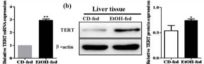 Western Blot: TERT Antibody (2C4) [NB100-317] - Effect of alcohol on TERT expression in liver tissues & KCs during ALD development.(a) TERT expression in liver tissues was performed by IHC analysis. Representative views from each group were presented (original magnification, ×40). (b) Total TERT mRNA & protein levels in liver tissue were analyzed by real-time PCR & western blot. The results are shown as relative expression against control expression without treatment. (c) Representative colocalization of TERT with macrophage CD68 immunoreactivity in liver tissue by using the double immunofluorescent (IF) analysis. (d) Total TERT mRNA & protein levels in KCs isolated from the liver were analyzed by real-time PCR & western blot. The results are shown as relative expression against control expression without treatment. (e) Quantification of telomerase activity (TA) in CD-fed mice & EtOH-fed mice. RNase treatment or heat inactivation of KCs isolated from the liver of EtOH-fed mice served as negative controls for the TA assay. All quantitative data are presented as mean ± SD percentage increase compared with CD-fed group (n = 4 in CD-fed group, n = 6 in EtOH-fed group) *P < 0.05, **P < 0.01 vs CD-fed group. Image collected & cropped by CiteAb from the following publication (//pubmed.ncbi.nlm.nih.gov/26725521), licensed under a CC-BY license. Not internally tested by Novus Biologicals.