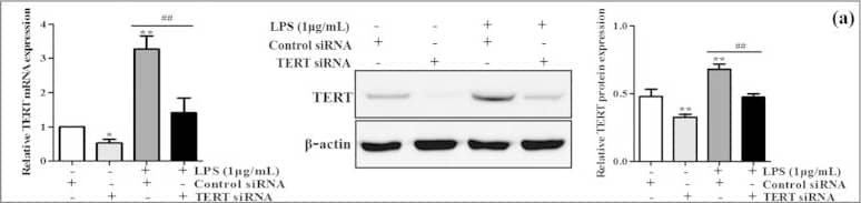 Western Blot: TERT Antibody (2C4) [NB100-317] - Effect of TERT silencing on murine M1 macrophage polarization.TERT siRNA & GV144-TERT were transiently transfected into LPS-treated RAW264.7 cells, respectively. (a) The endogeous TERT levels were detected by real-time PCR & western blot. The results are shown as relative expression against control expression without treatment. (b) The mRNA levels of M1 macrophages biomarkers including TNF-alpha , IL-1 beta , NOS2 & CCL2 were detected by real-time PCR. The results are shown as relative expression against control expression without treatment. (c) The secretion of proinflammatory cytokines including TNF-alpha , IL-1 beta , IL-6 & IL-12 were determined by ELISA. (d) TERT successful over-expression was verified by real-time PCR & western blot in LPS-stimulated RAW 264.7 cells. The results are shown as relative expression against control expression without treatment. (e) The mRNA levels of M1 macrophages biomarkers were detected by real-time PCR. The results are shown as relative expression against control expression without treatment. (f) The secretion of proinflammatory cytokines were determined by ELISA. Data shown are the mean ± SD from 3 independent experiments. *P < 0.05, **P < 0.01 vs control group. #P < 0.05, ##P < 0.01 vs LPS-treated group. Image collected & cropped by CiteAb from the following publication (//pubmed.ncbi.nlm.nih.gov/26725521), licensed under a CC-BY license. Not internally tested by Novus Biologicals.