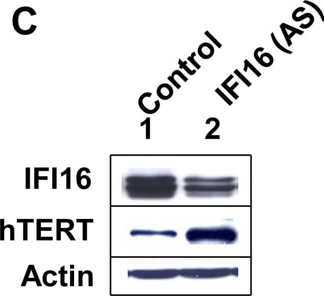 Western Blot: TERT Antibody (2C4) [NB100-317] - IFI16 inhibits c-Myc-stimulated transcription & hTERT expression in HeLa cells.(A) Total protein extracts prepared from HeLa cells infected with control retrovirus (lane 1) or a virus encoding IFI16 protein (lane 2) were subjected to immunoblotting using antibodies specific to the indicated proteins. (B) Sub-confluent cultures of HeLa cells were transfected with pMyc-TA-luc reporter plasmid (1.0 µg) along with a second pRL-TK reporter plasmid (0.2 µg) & an empty plasmid (pCMV; column 1), a plasmid encoding c-Myc (column 2 & 4), a plasmid encoding IFI16 (column 3), or both plasmids encoding c-Myc & increasing amounts of the plasmid encoding IFI16 protein (column 5 & 6). After 44–48 h of transfections, cells were lysed & the lysates were analyzed for dual luciferase activity. Normalized relative luciferase activity in control cells is indicated as 1.0. (C) Total protein extracts prepared from HeLa cells infected with control retrovirus (lane 1) or a virus encoding antisense to IFI16 mRNA (lanes 2) were subjected to immunoblotting using antibodies specific to the indicated proteins. Image collected & cropped by CiteAb from the following publication (//dx.plos.org/10.1371/journal.pone.0008569), licensed under a CC0-1.0 license. Not internally tested by Novus Biologicals.