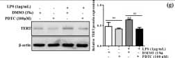 Western Blot: TERT Antibody (2C4) [NB100-317] - The interaction of TERT with p65 in murine macrophages.(a) Expression of p65 in liver tissue was analyzed by IHC staining analysis. Representative views from each group were presented (original magnification, ×40). (b) The protein expression & phosphorylation of p65 at Ser 536 were observed in liver tissue & KCs isolated from the liver by WB. The results are shown as relative expression against control expression without treatment. Values represent means ± SD. (n = 4 in CD-fed group, n=6 in EtOH-fed group) *P < 0.05, **P < 0.01 vs liver tissues of CD-fed group. #P < 0.05, ##P < 0.01 vs KCs of CD-fed group. (c) p65 protein expression & phosphorylation were analyzed in total cell lysates of M0, M1 & M2 macrophages by WB. The results are shown as relative expression against control expression without treatment. Data shown are the mean ± SD from 3 independent experiments. *P < 0.05, **P < 0.01 vs control. (d) Representative colocalization of TERT with macrophage p65 immunoreactivity in liver tissue by using the double immunofluorescent (IF) analysis. (e) Effect of TERT on p65 expression & activation in LPS-stimulated RAW 264.7 cells. Expression of p65 & phosphorylated p65 were determined by WB. (f) Effect of PDTC on p65 expression in LPS-stimulated RAW 264.7 cells. Expression of p65 was determined by WB. (g) Expression of TERT upon treatment with PDTC was determined by WB in LPS-stimulated RAW 264.7 cells. (h) Effect of PDTC on the expression of M1 macrophage biomarkers in LPS-stimulated RAW 264.7 cells. The results are shown as relative expression against control expression without treatment. Data shown are the mean ± SD from 3 independent experiments. *P < 0.05, **P < 0.01 vs control. #P < 0.05, ##P < 0.01 vs LPS-treated group. Image collected & cropped by CiteAb from the following publication (//pubmed.ncbi.nlm.nih.gov/26725521), licensed under a CC-BY license. Not internally tested by Novus Biologicals.