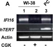 Western Blot: TERT Antibody (2C4) [NB100-317] - Reduced expression levels of IFI16 protein in human normal diploid fibroblasts after treatment with histone deacetylase inhibitor are associated with increased expression of hTERT & increased telomerase activity.(A) Total RNA isolated from untreated (control, lane 1) or CGK1026 (10 µM for 24 h, lane 2) treated young WI-38 fibroblasts was subjected cDNA synthesis followed by semi-quantitative PCR using a pair of primer specific to the IFI16, hTERT, or actin. As a positive control, we used RNA from human HT1080, a human fibrosarcoma cell line. (B) Total RNA isolated from untreated (control) or CGK1026 (10 µM for 24 h; treated) treated young WI-38 fibroblasts was subjected cDNA synthesis, followed by quantitative real-time PCR using the TaqMan assay for the hTERT gene. Results are mean values of triplicate experiments & error bars represent standard deviation (**p<0.005). (C & D) Total protein extracts prepared from untreated (lane 1) or CGK1026 (10 µM for 24 h; treated) treated young WI-38 fibroblasts were subjected to immunoblotting using antibodies specific to the indicated proteins. Image collected & cropped by CiteAb from the following publication (//dx.plos.org/10.1371/journal.pone.0008569), licensed under a CC0-1.0 license. Not internally tested by Novus Biologicals.