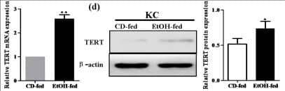 Western Blot: TERT Antibody (2C4) [NB100-317] - Effect of alcohol on TERT expression in liver tissues & KCs during ALD development.(a) TERT expression in liver tissues was performed by IHC analysis. Representative views from each group were presented (original magnification, ×40). (b) Total TERT mRNA & protein levels in liver tissue were analyzed by real-time PCR & western blot. The results are shown as relative expression against control expression without treatment. (c) Representative colocalization of TERT with macrophage CD68 immunoreactivity in liver tissue by using the double immunofluorescent (IF) analysis. (d) Total TERT mRNA & protein levels in KCs isolated from the liver were analyzed by real-time PCR & western blot. The results are shown as relative expression against control expression without treatment. (e) Quantification of telomerase activity (TA) in CD-fed mice & EtOH-fed mice. RNase treatment or heat inactivation of KCs isolated from the liver of EtOH-fed mice served as negative controls for the TA assay. All quantitative data are presented as mean ± SD percentage increase compared with CD-fed group (n = 4 in CD-fed group, n = 6 in EtOH-fed group) *P < 0.05, **P < 0.01 vs CD-fed group. Image collected & cropped by CiteAb from the following publication (//pubmed.ncbi.nlm.nih.gov/26725521), licensed under a CC-BY license. Not internally tested by Novus Biologicals.