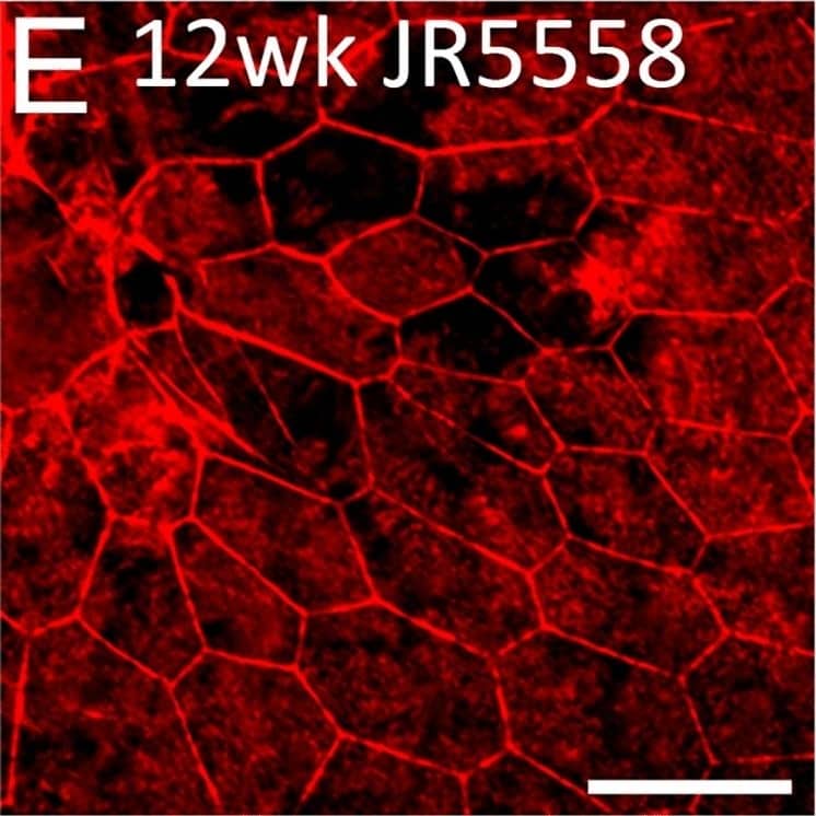 Altered RPE structure and cell morphology in JR5558 mice. Immunofluorescence imaging of JR5558 retinal sections with antibodies against GFAP (green) and RPE65 (red) revealed subretinal Müller cell gliosis and altered RPE structure around the lesion area (A), corresponding to the altered outer retina and RPE structure noted in OCT image (B). Arrow and arrowhead highlighting subretinal gliosis and altered RPE, respectively. Phalloidin staining of JR5558 retinal flatmounts revealed the normal morphology of RPE cells at 4 (C) and 8 weeks (D) is changed from 12 weeks onwards (E–F). Dashed box represents area imaged in panel A. Scale bars: 50 μm. Image collected and cropped by CiteAb from the following open publication (//www.nature.com/articles/s41598-024-66068-z), licensed under a CC-BY license. Not internally tested by Novus Biologicals.