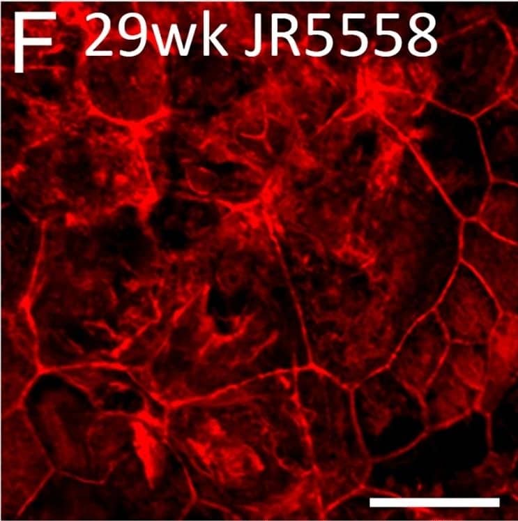 Altered RPE structure and cell morphology in JR5558 mice. Immunofluorescence imaging of JR5558 retinal sections with antibodies against GFAP (green) and RPE65 (red) revealed subretinal Müller cell gliosis and altered RPE structure around the lesion area (A), corresponding to the altered outer retina and RPE structure noted in OCT image (B). Arrow and arrowhead highlighting subretinal gliosis and altered RPE, respectively. Phalloidin staining of JR5558 retinal flatmounts revealed the normal morphology of RPE cells at 4 (C) and 8 weeks (D) is changed from 12 weeks onwards (E–F). Dashed box represents area imaged in panel A. Scale bars: 50 μm. Image collected and cropped by CiteAb from the following open publication (//www.nature.com/articles/s41598-024-66068-z), licensed under a CC-BY license. Not internally tested by Novus Biologicals.