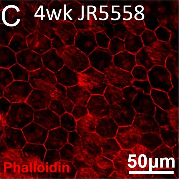 Altered RPE structure and cell morphology in JR5558 mice. Immunofluorescence imaging of JR5558 retinal sections with antibodies against GFAP (green) and RPE65 (red) revealed subretinal Müller cell gliosis and altered RPE structure around the lesion area (A), corresponding to the altered outer retina and RPE structure noted in OCT image (B). Arrow and arrowhead highlighting subretinal gliosis and altered RPE, respectively. Phalloidin staining of JR5558 retinal flatmounts revealed the normal morphology of RPE cells at 4 (C) and 8 weeks (D) is changed from 12 weeks onwards (E–F). Dashed box represents area imaged in panel A. Scale bars: 50 μm. Image collected and cropped by CiteAb from the following open publication (//www.nature.com/articles/s41598-024-66068-z), licensed under a CC-BY license. Not internally tested by Novus Biologicals.