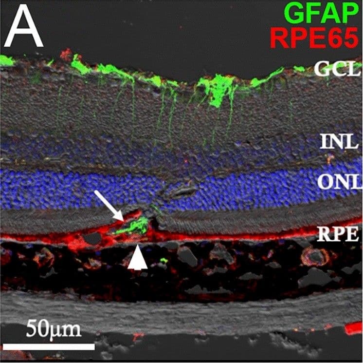 Altered RPE structure and cell morphology in JR5558 mice. Immunofluorescence imaging of JR5558 retinal sections with antibodies against GFAP (green) and RPE65 (red) revealed subretinal Müller cell gliosis and altered RPE structure around the lesion area (A), corresponding to the altered outer retina and RPE structure noted in OCT image (B). Arrow and arrowhead highlighting subretinal gliosis and altered RPE, respectively. Phalloidin staining of JR5558 retinal flatmounts revealed the normal morphology of RPE cells at 4 (C) and 8 weeks (D) is changed from 12 weeks onwards (E–F). Dashed box represents area imaged in panel A. Scale bars: 50 μm. Image collected and cropped by CiteAb from the following open publication (//www.nature.com/articles/s41598-024-66068-z), licensed under a CC-BY license. Not internally tested by Novus Biologicals.